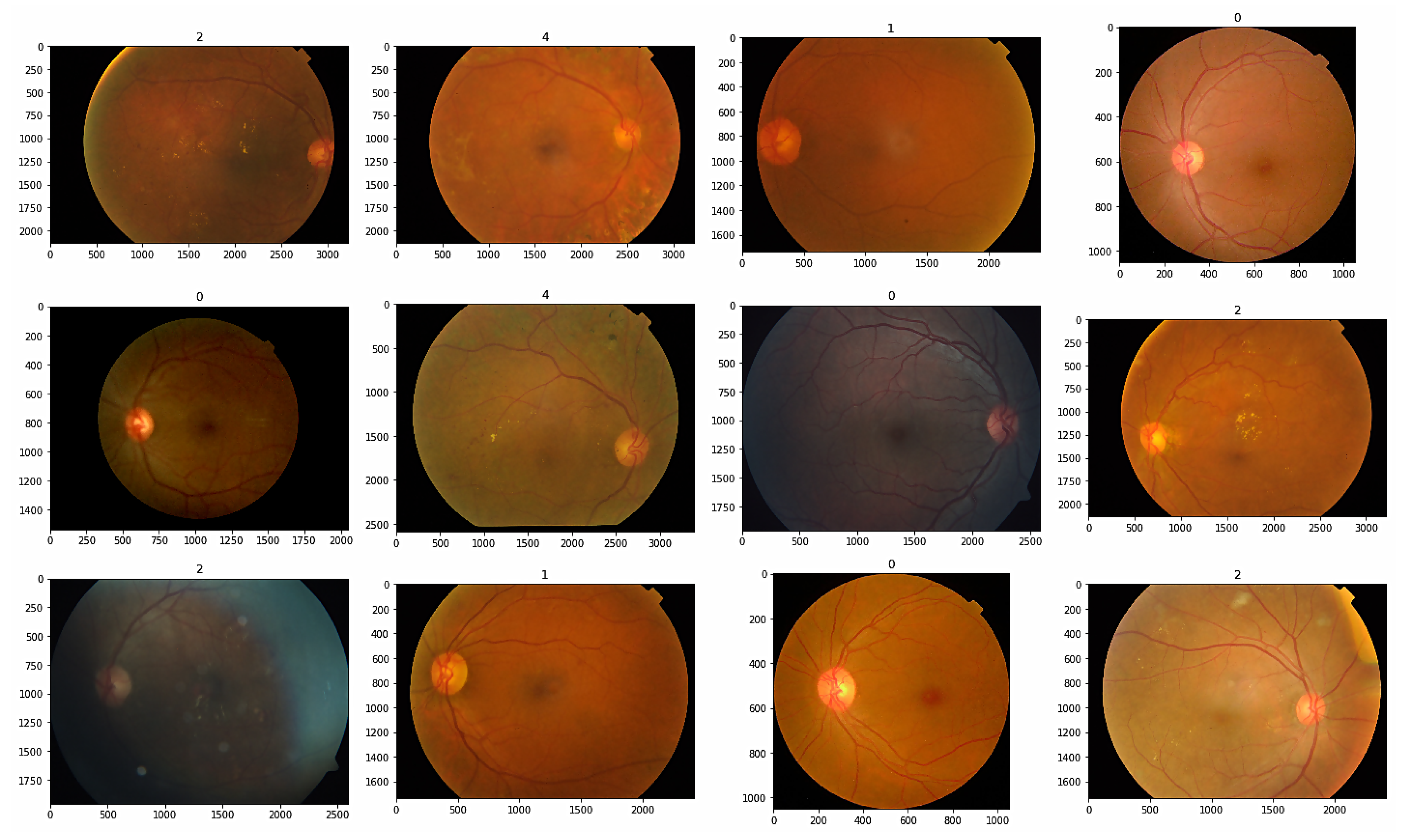 Sensors 23 05726 g006