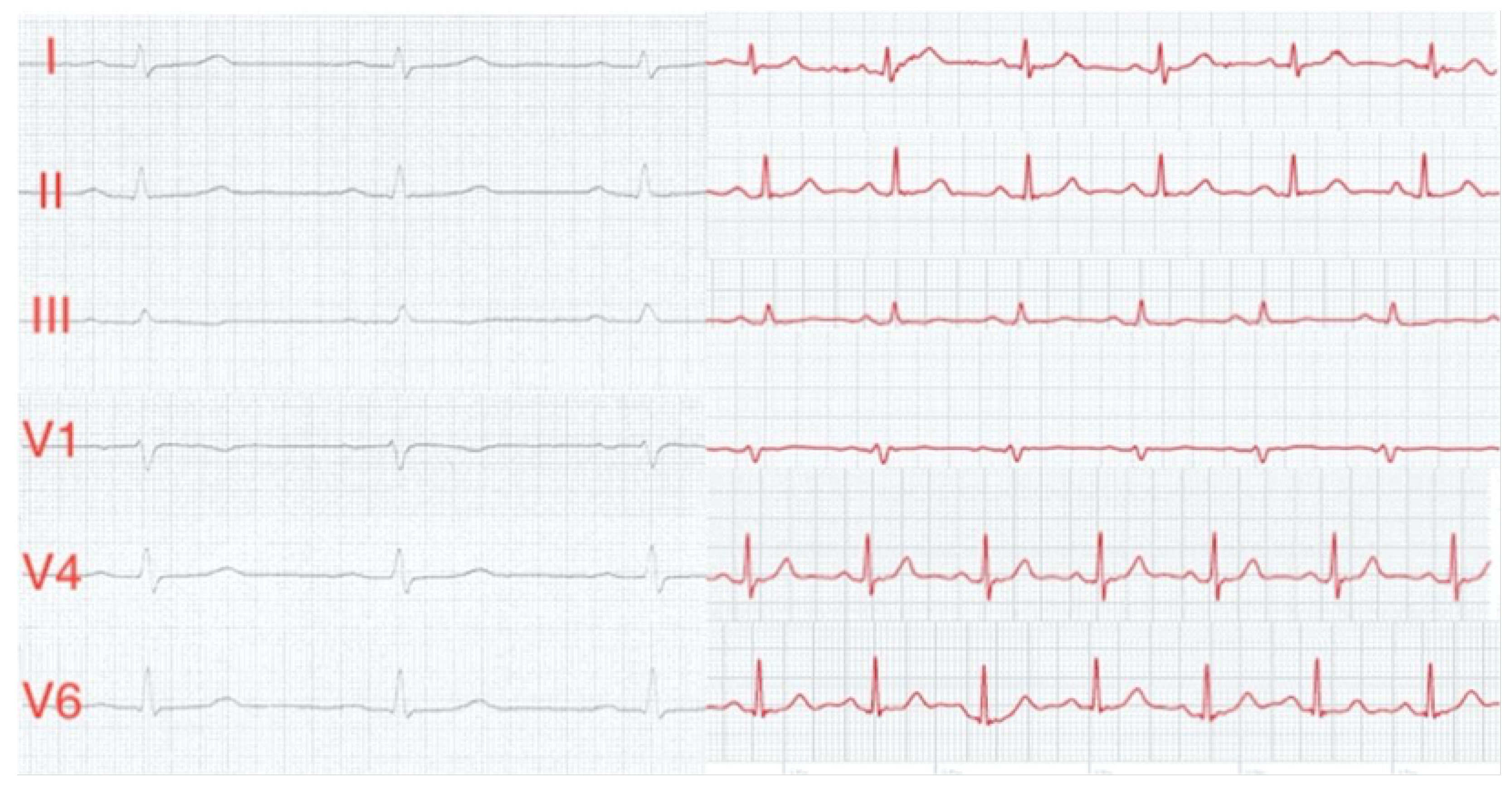 Sensors 23 05752 g020