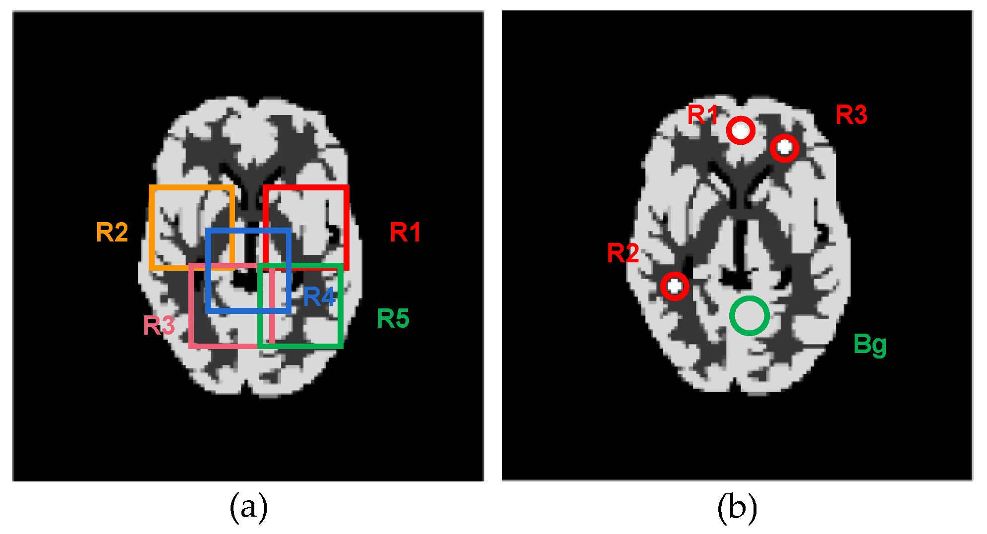 Sensors 23 05783 g010
