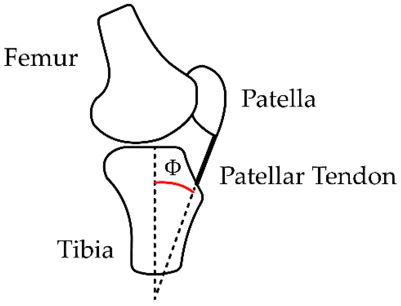 Sensors 23 05827 g006