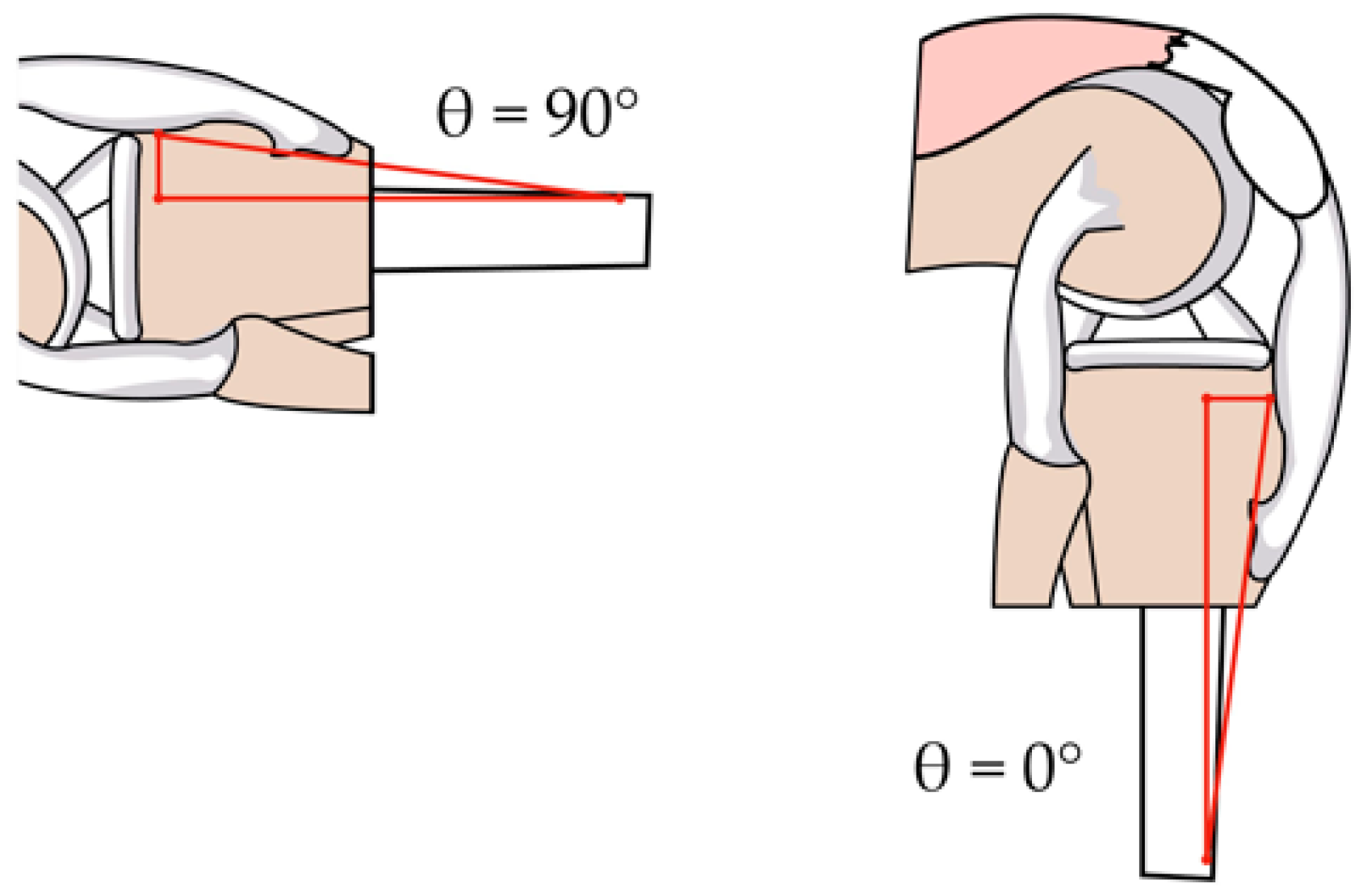 Sensors 23 05827 g008