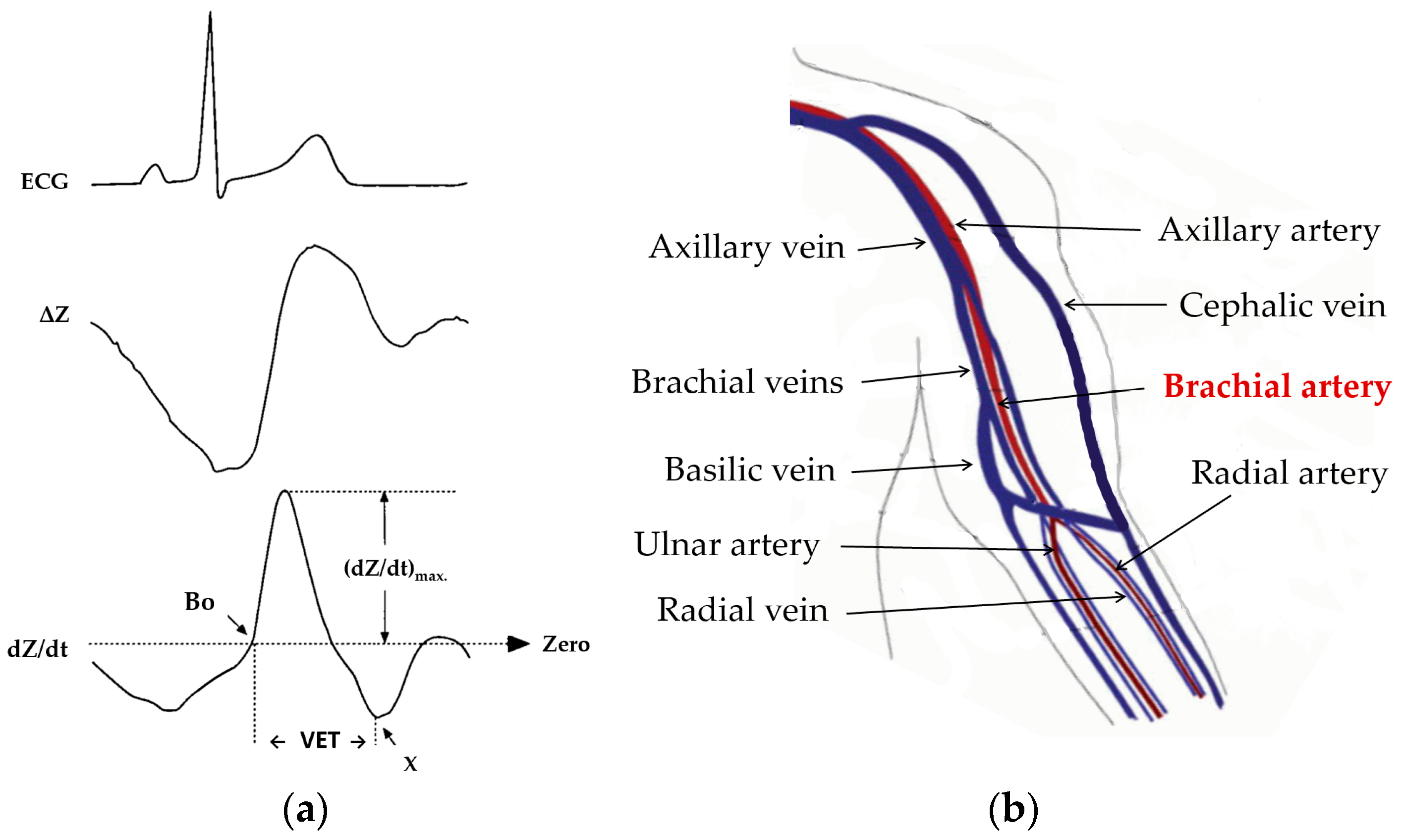 Sensors 23 05892 g001
