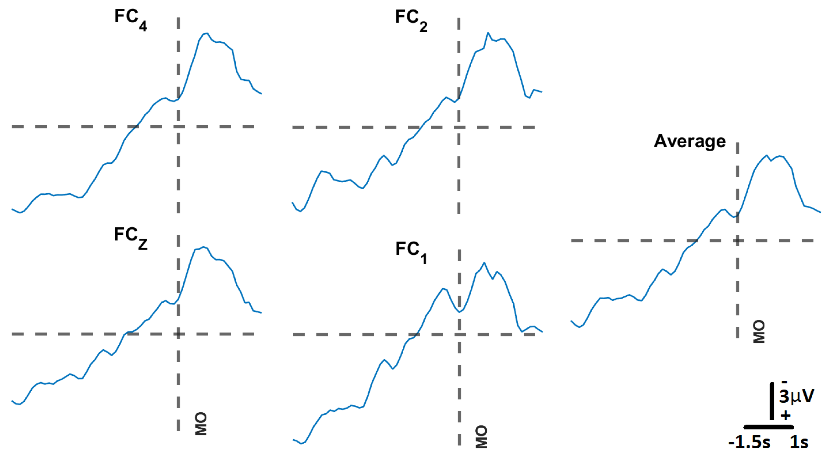 Sensors 23 05930 g010