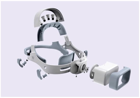 Sensors 23 05930 g0a1