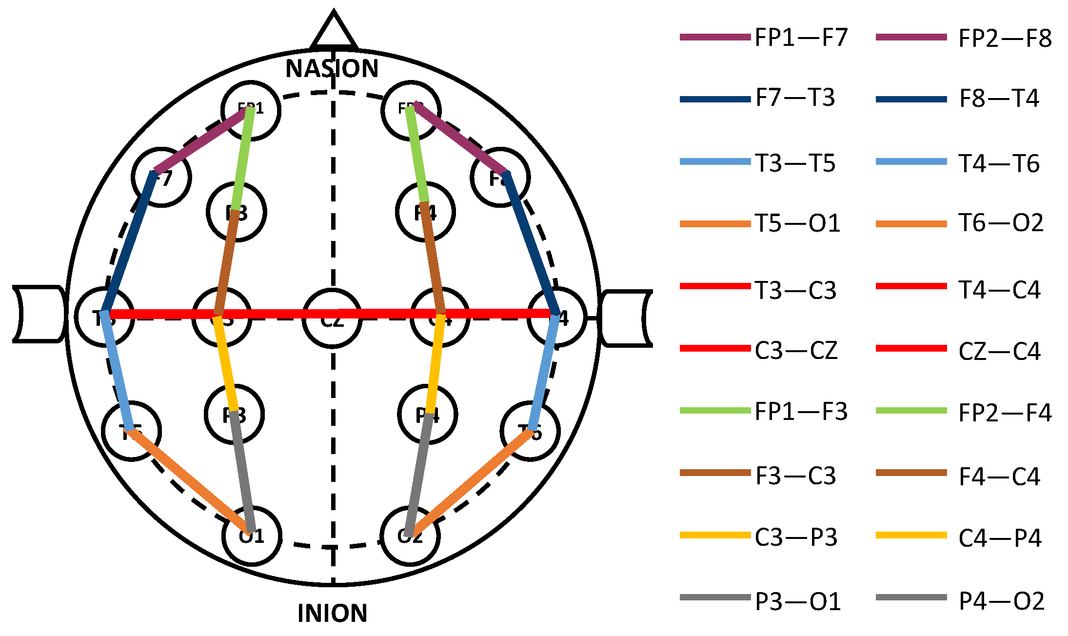 Sensors 23 05960 g002