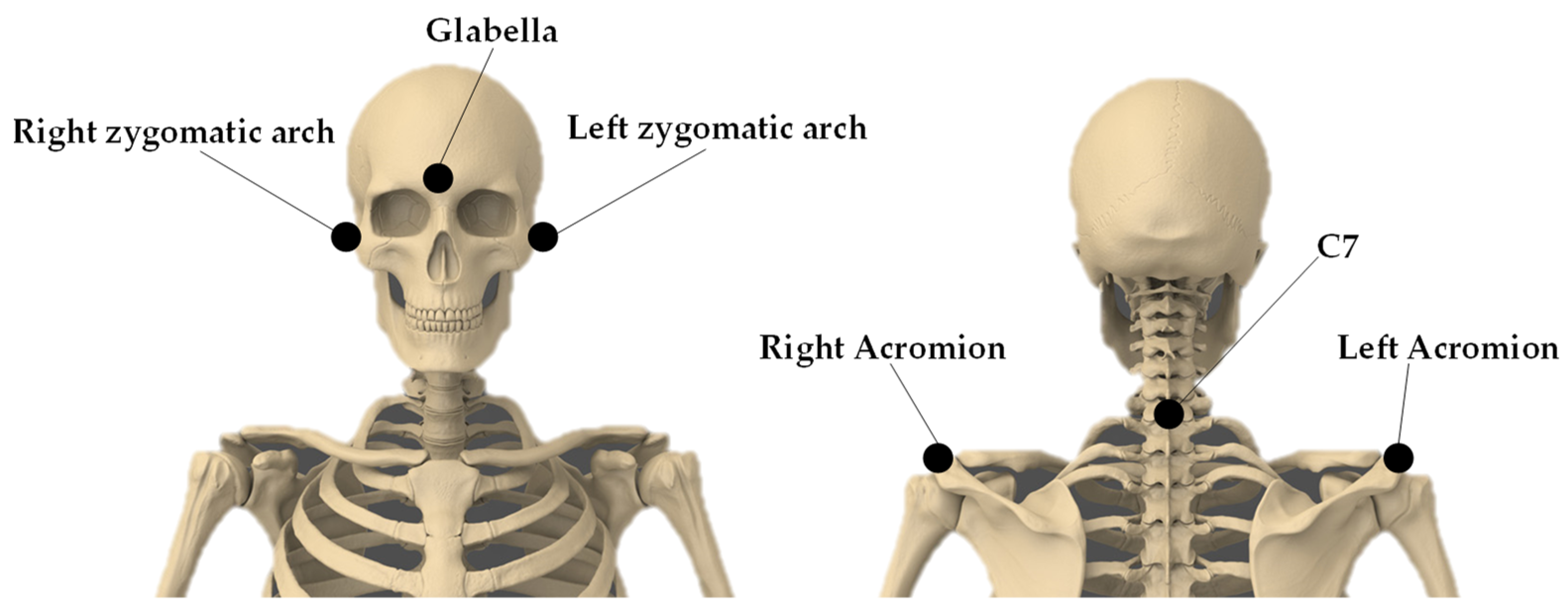 Sensors 23 06013 g001