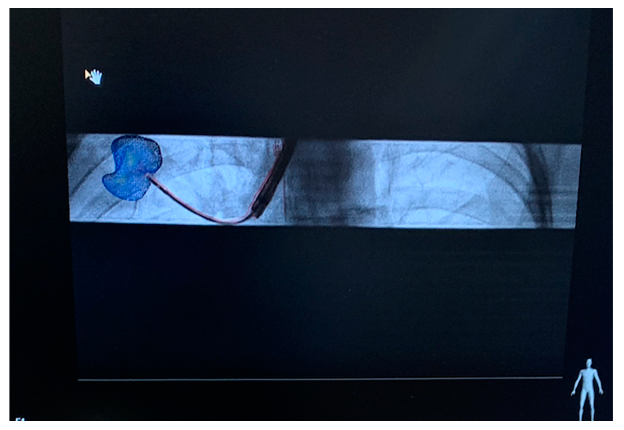 Sensors 23 06202 g005