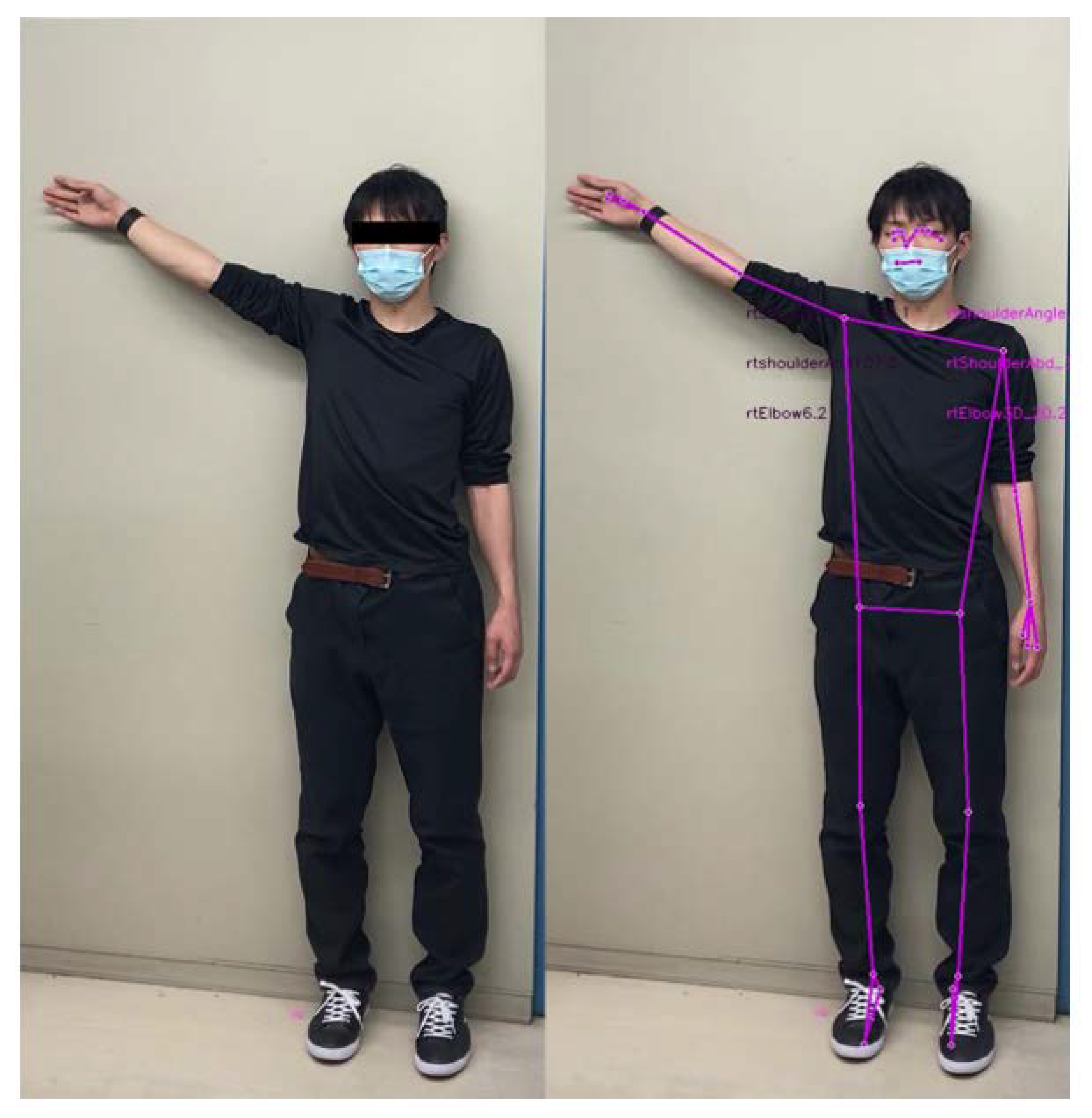 Sensors 23 06445 g005