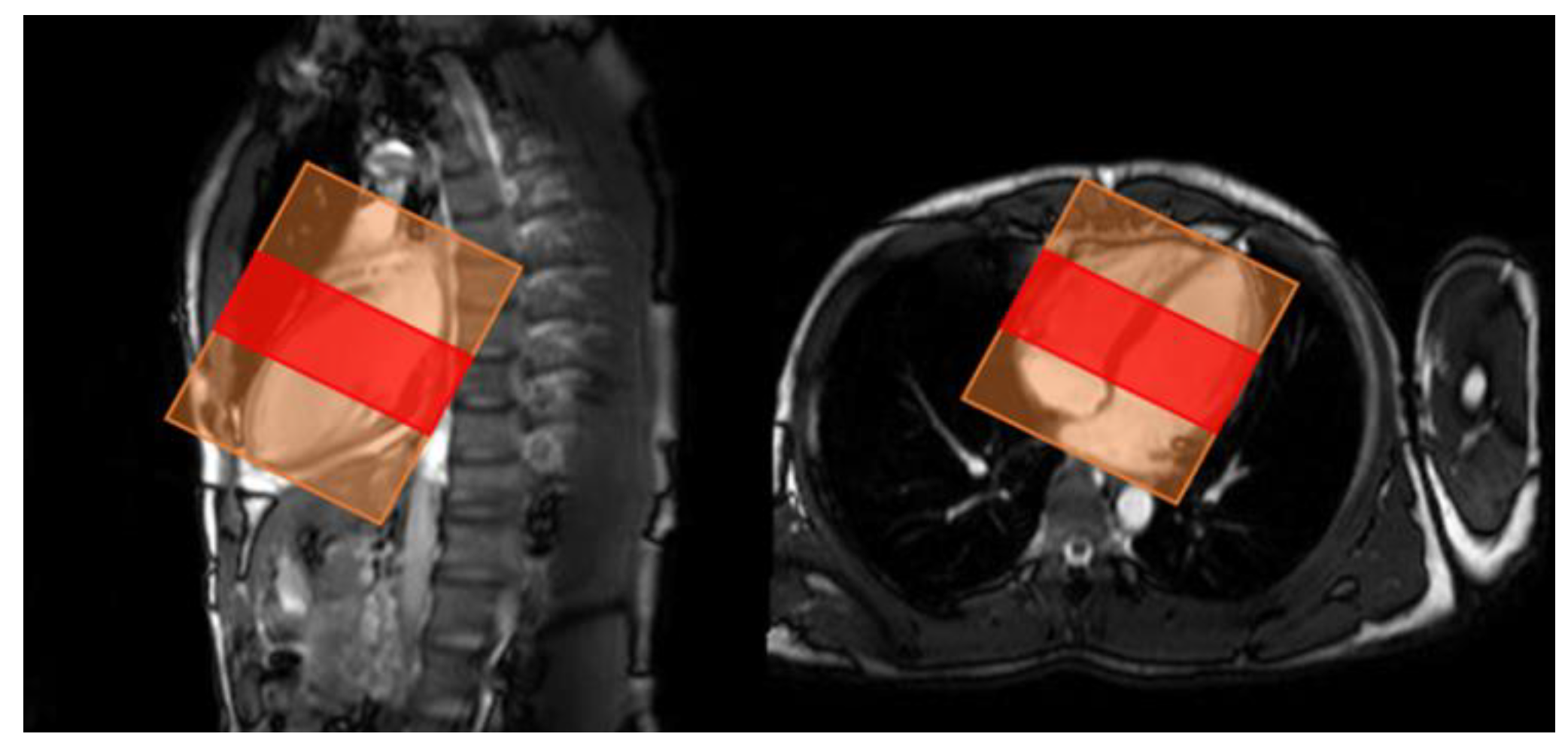 Sensors 23 06580 g002