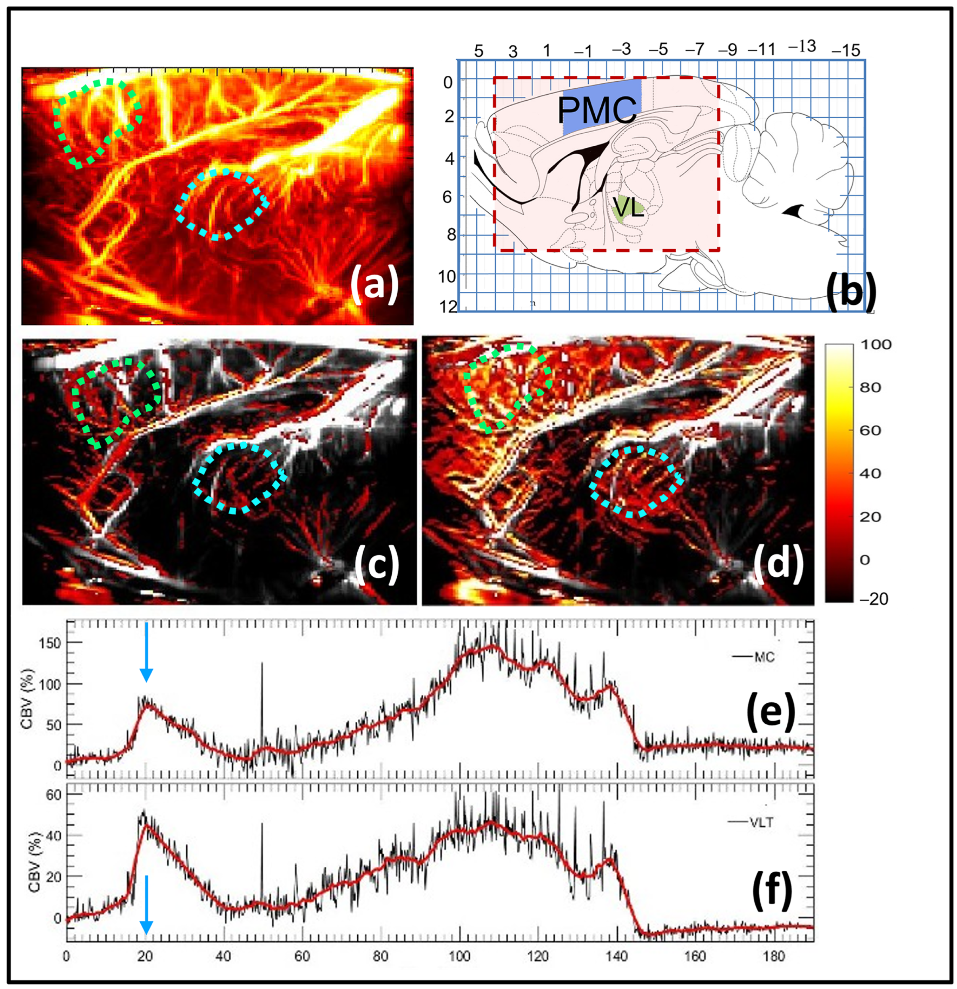 Sensors 23 06902 g004