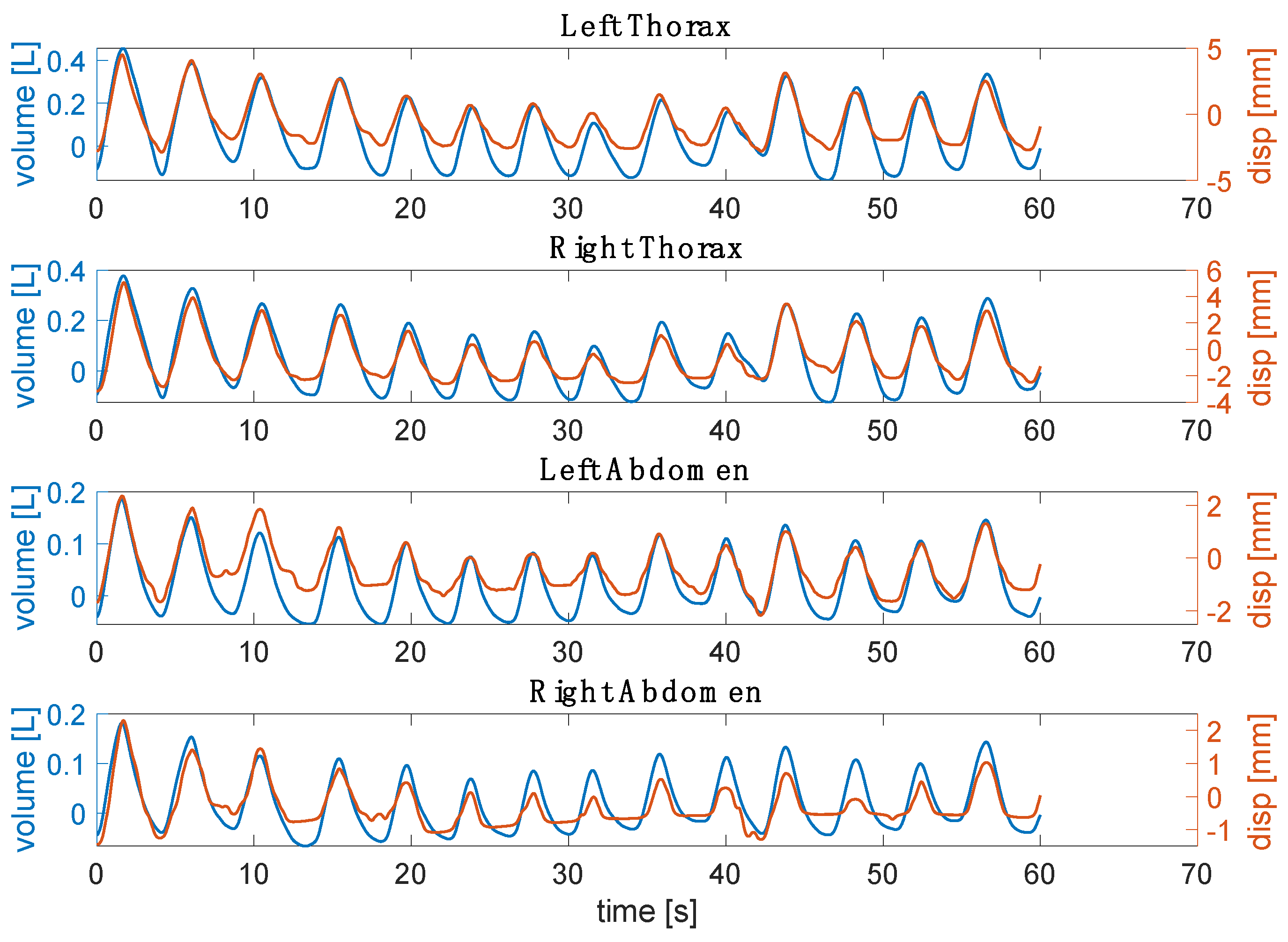 Sensors 23 06960 g008