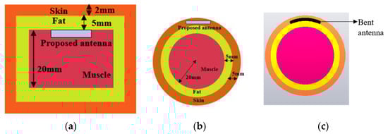Sensors 23 06989 g001