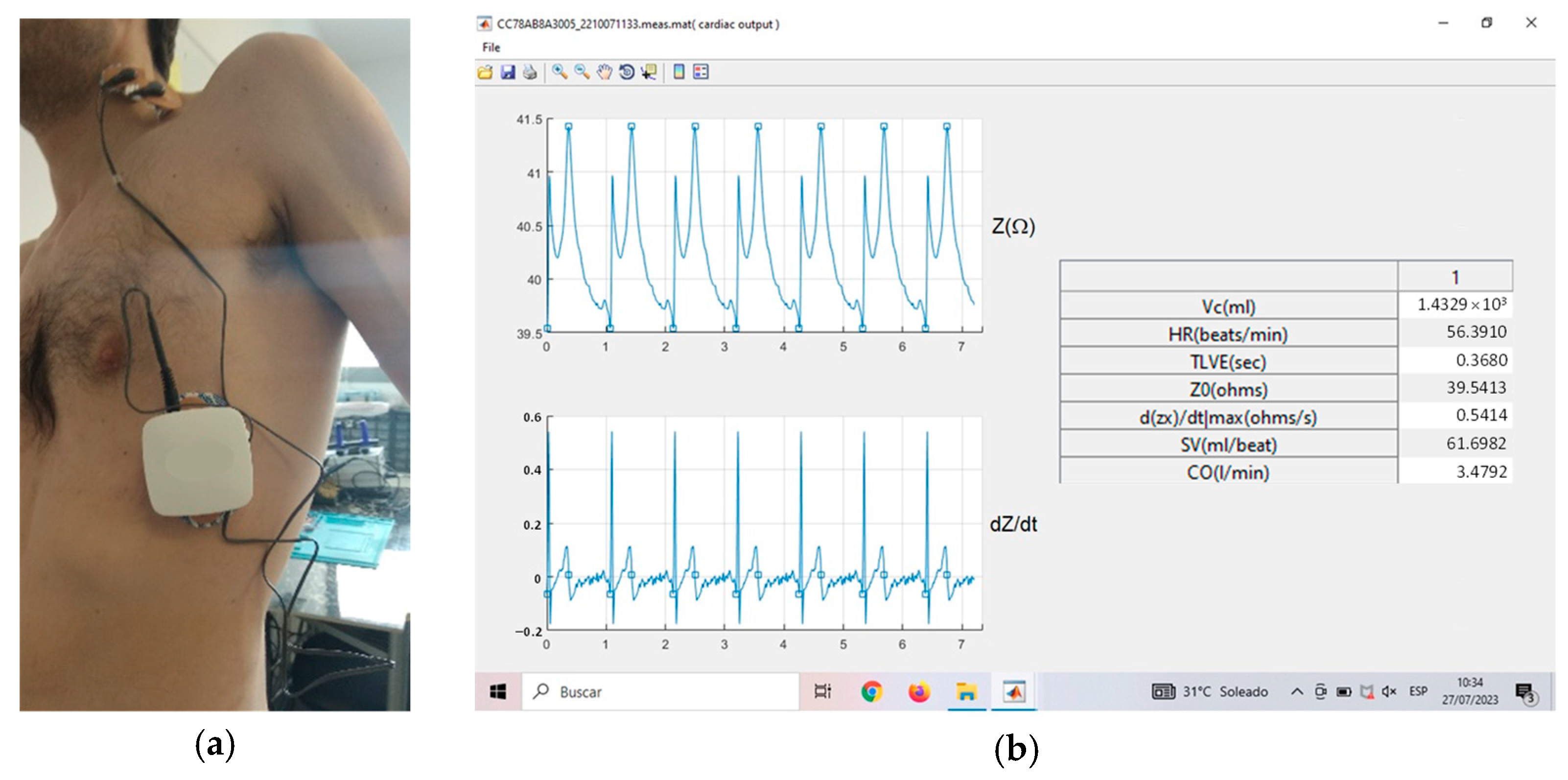 Sensors 23 07055 g010