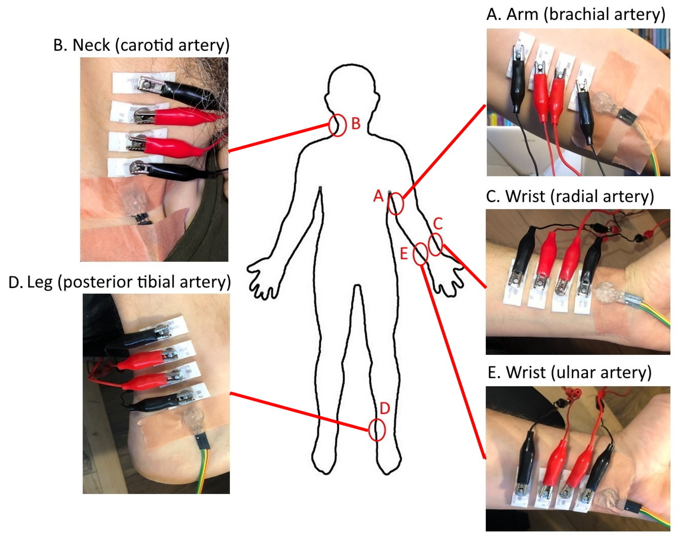 Sensors 23 07111 g001