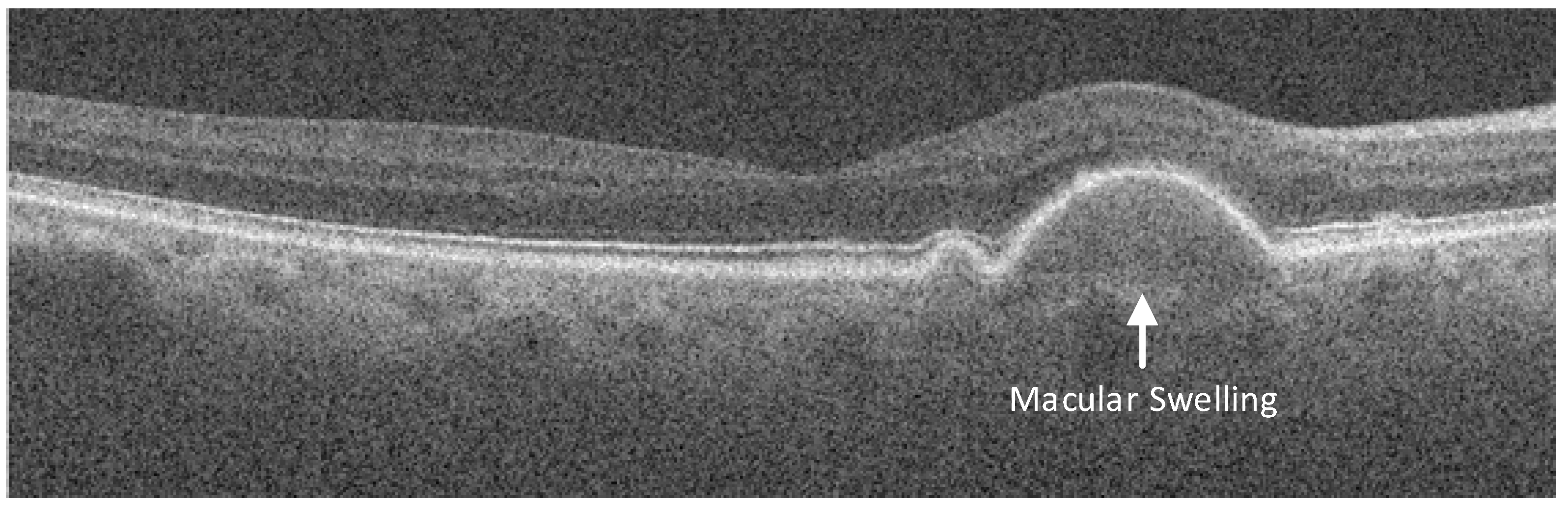 Sensors 23 07315 g001