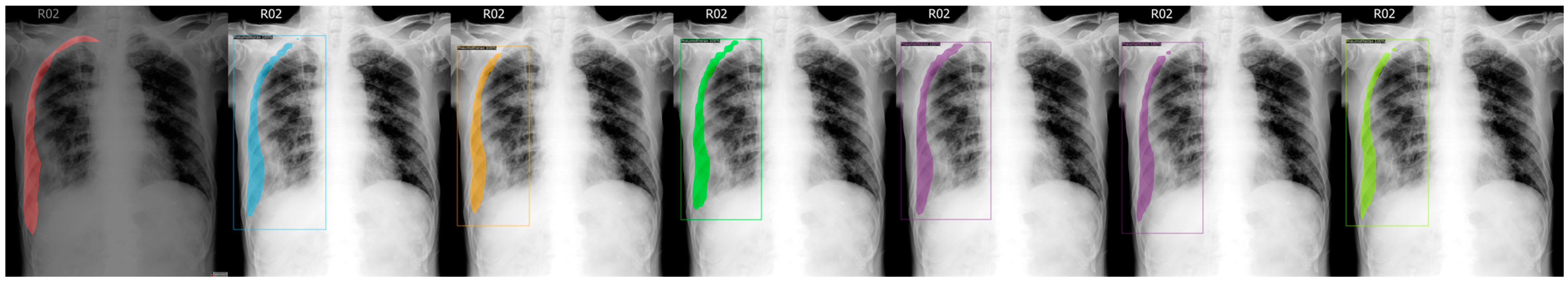 Sensors 23 07369 g003