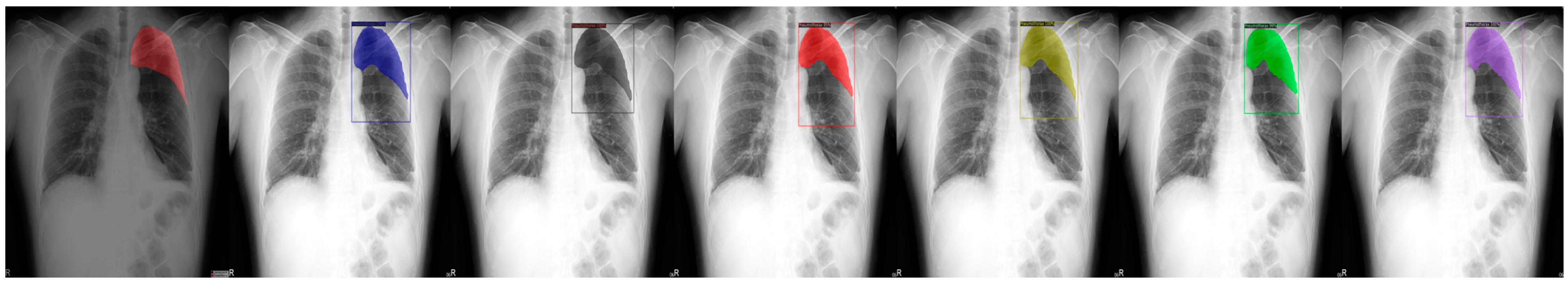 Sensors 23 07369 g004