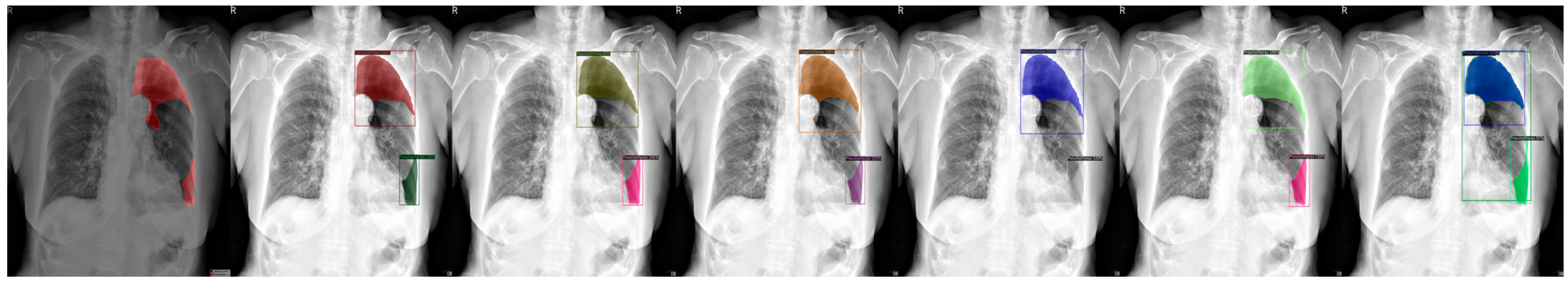 Sensors 23 07369 g005