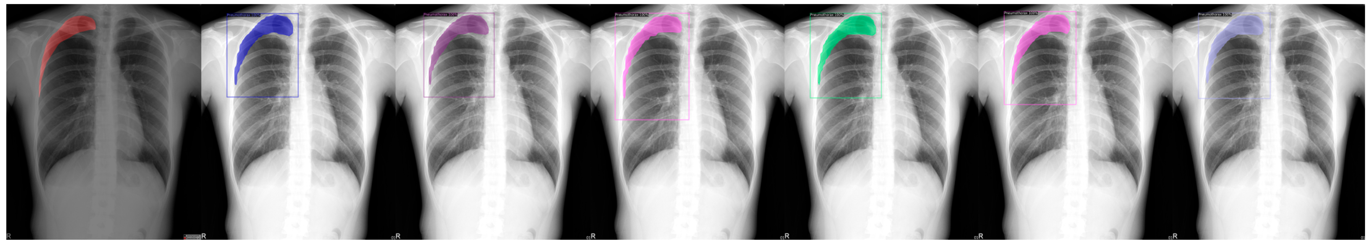 Sensors 23 07369 g006