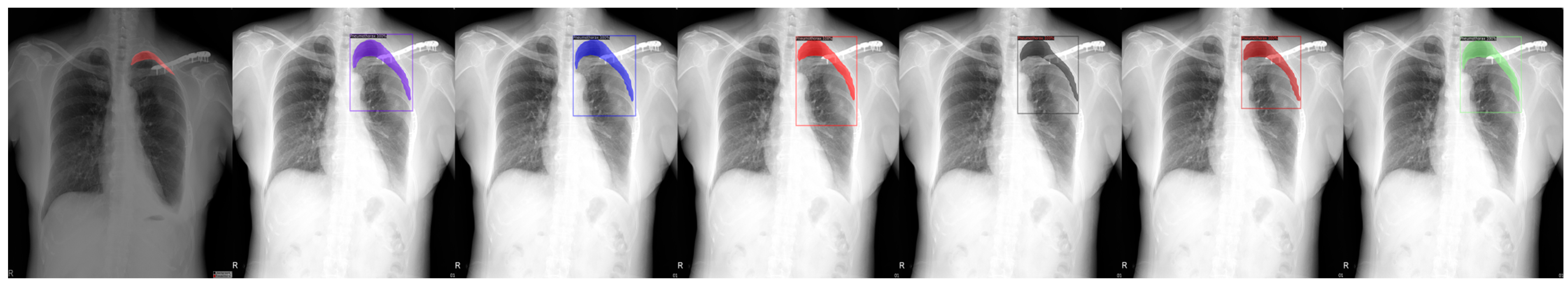 Sensors 23 07369 g007