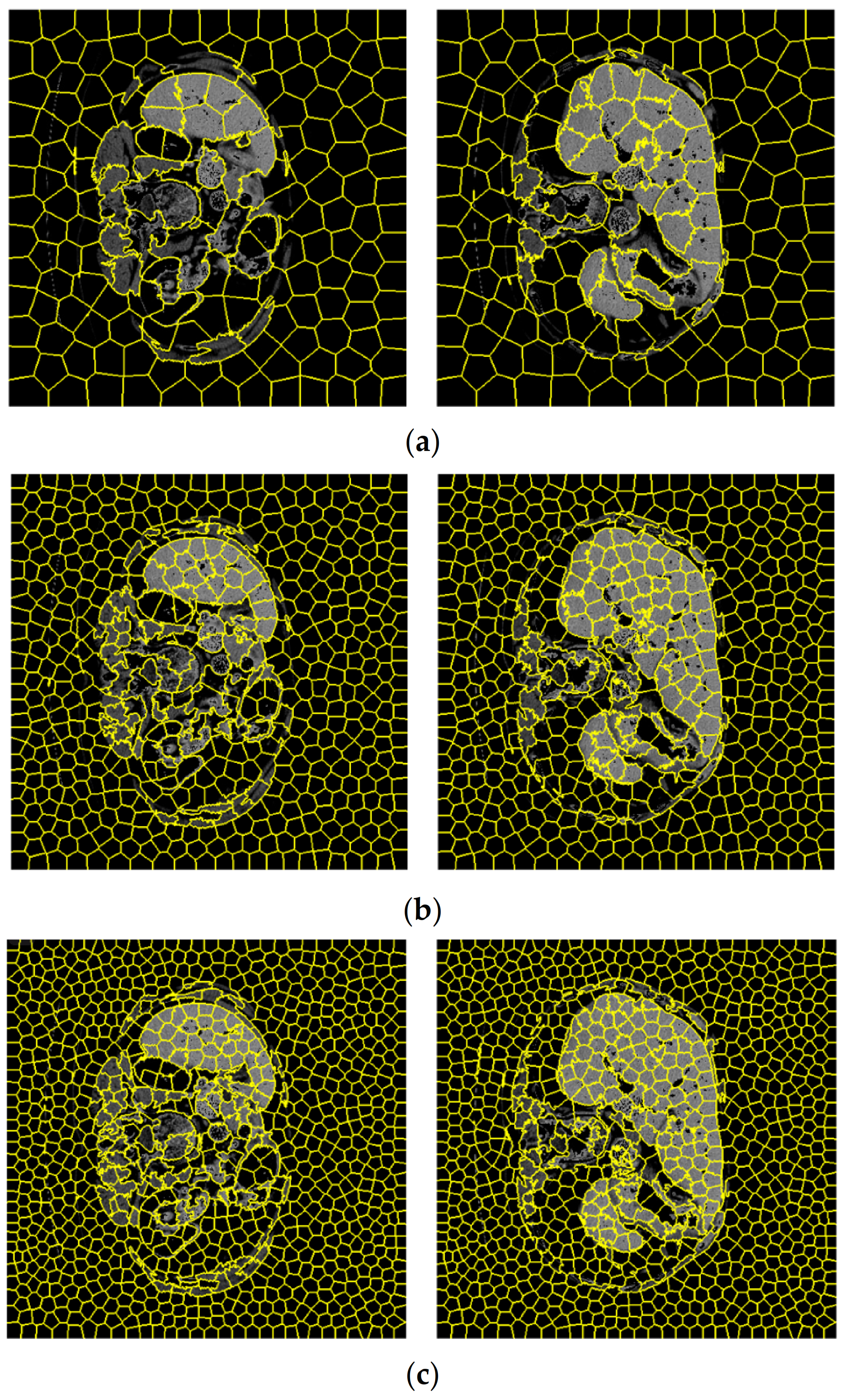 Sensors 23 07561 g012