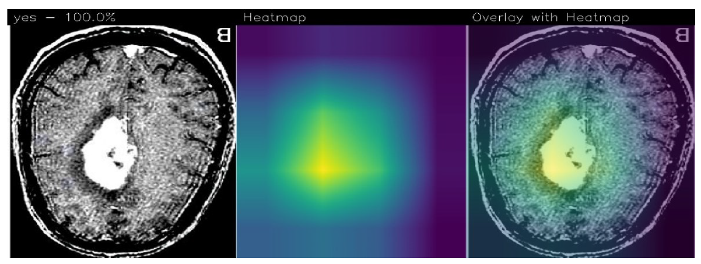 Sensors 23 07614 g004