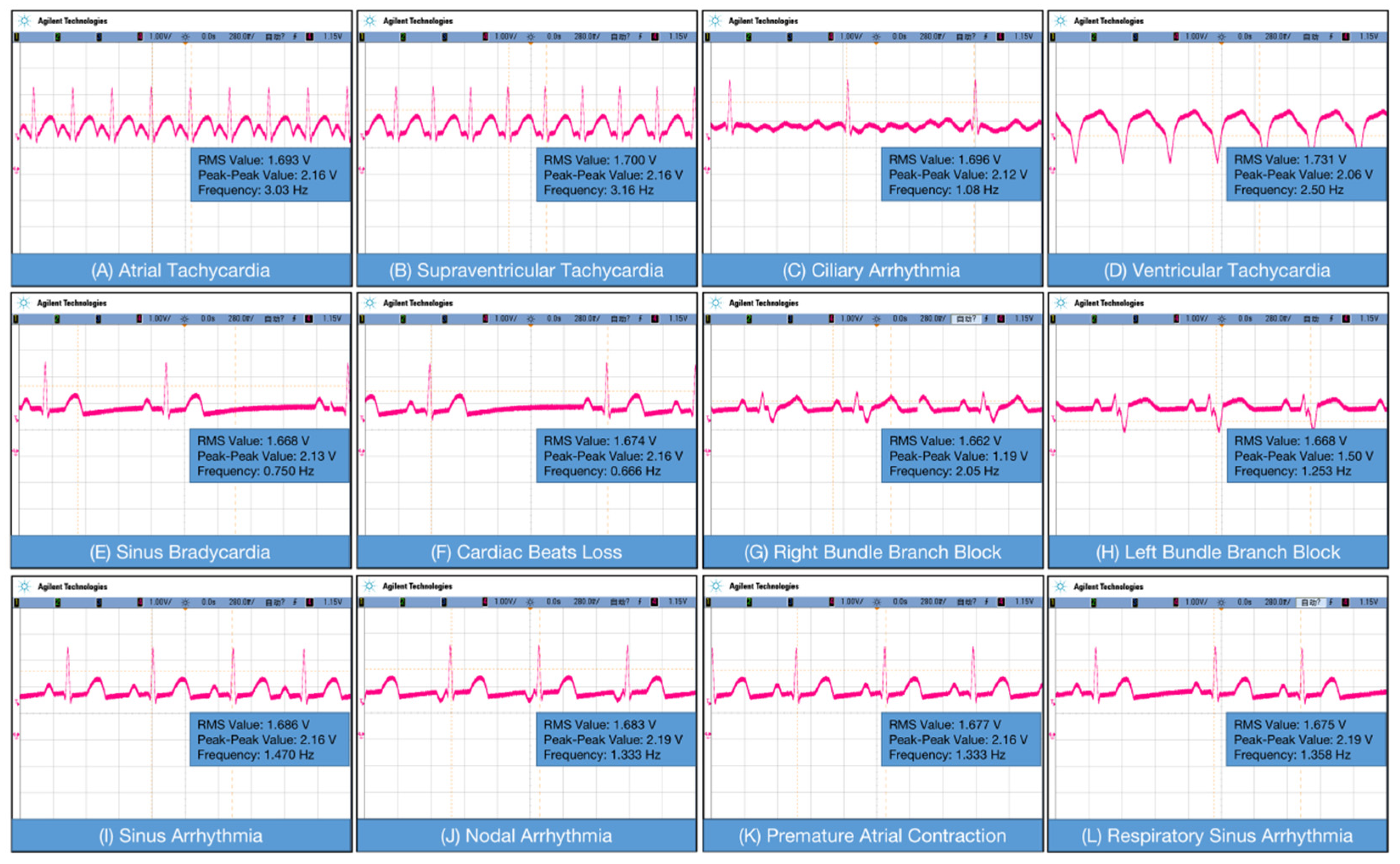 Sensors 23 07643 g005