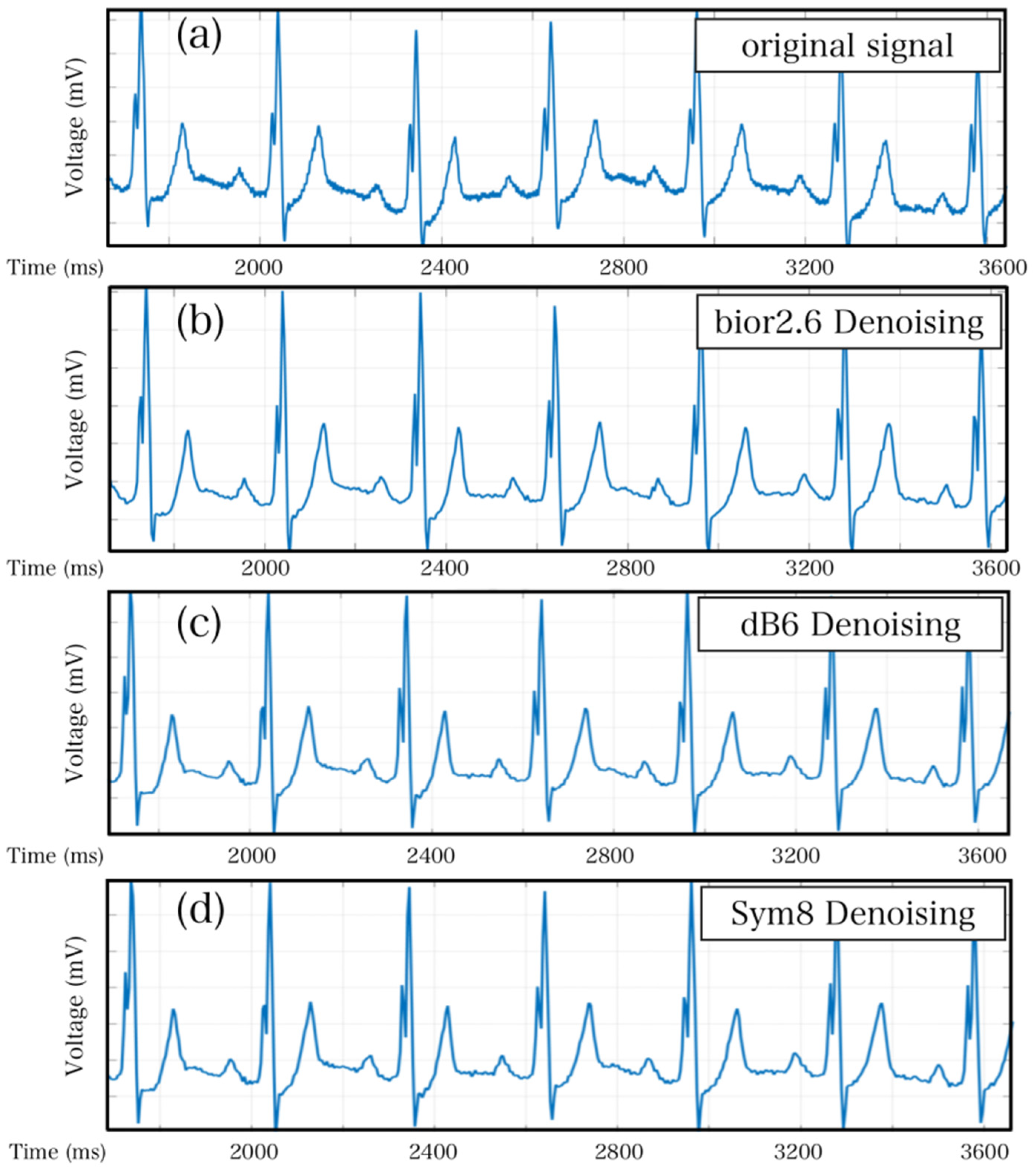 Sensors 23 07643 g007