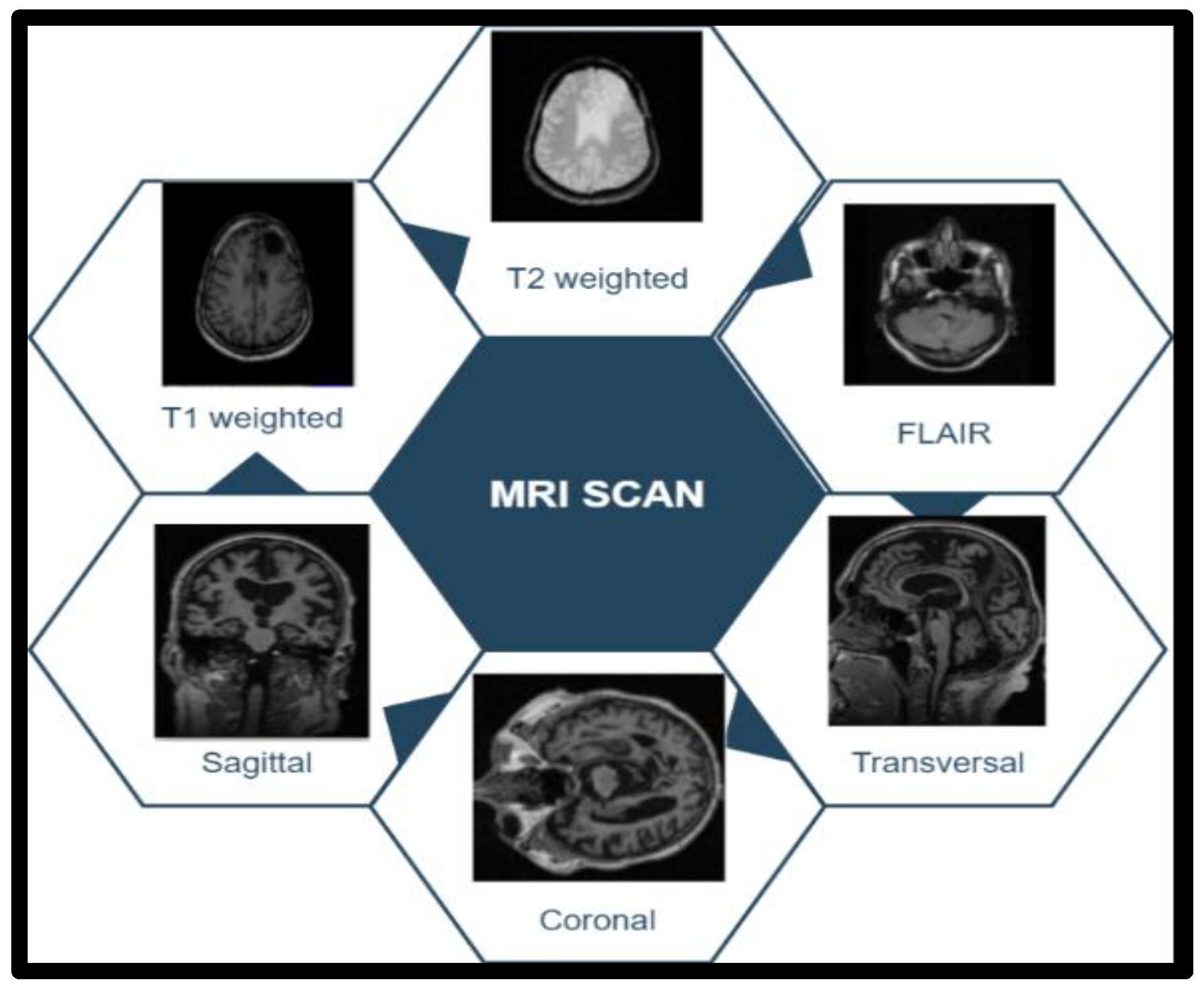 Sensors 23 07816 g003