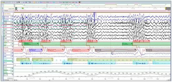 Sensors 23 07924 g001