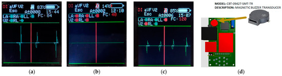 Sensors 23 08303 g014