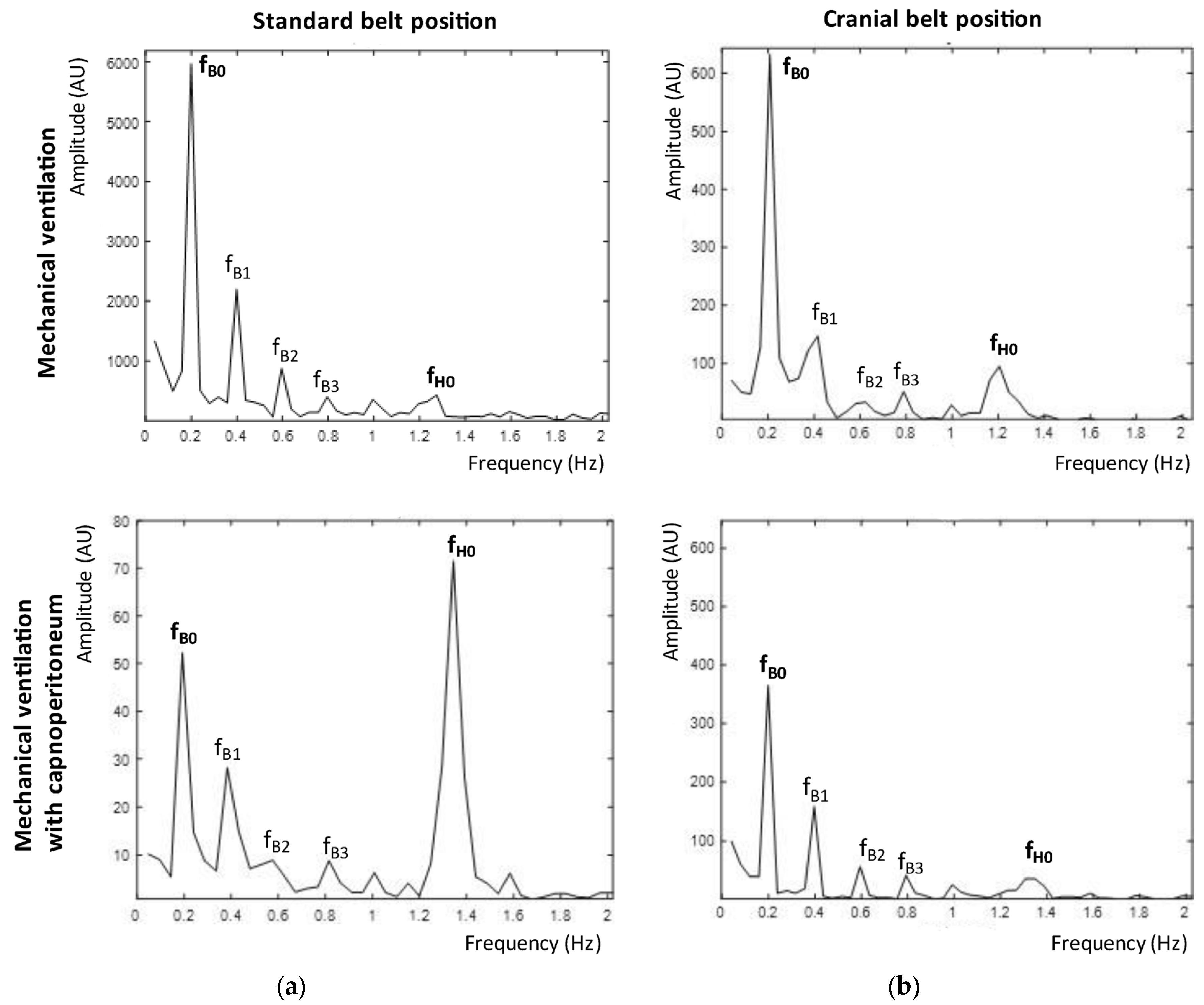 Sensors 23 08644 g005