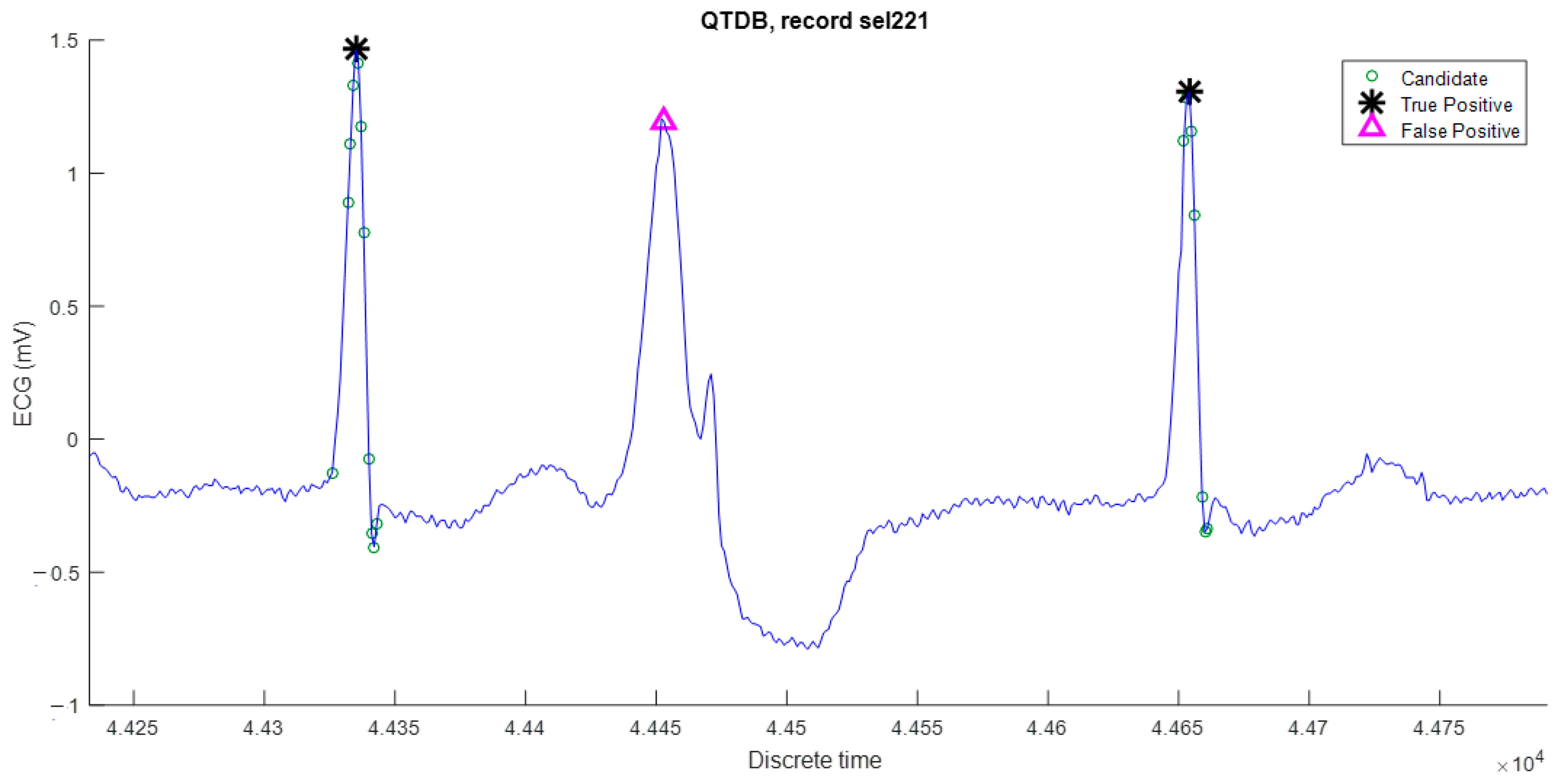 Sensors 23 08796 g006