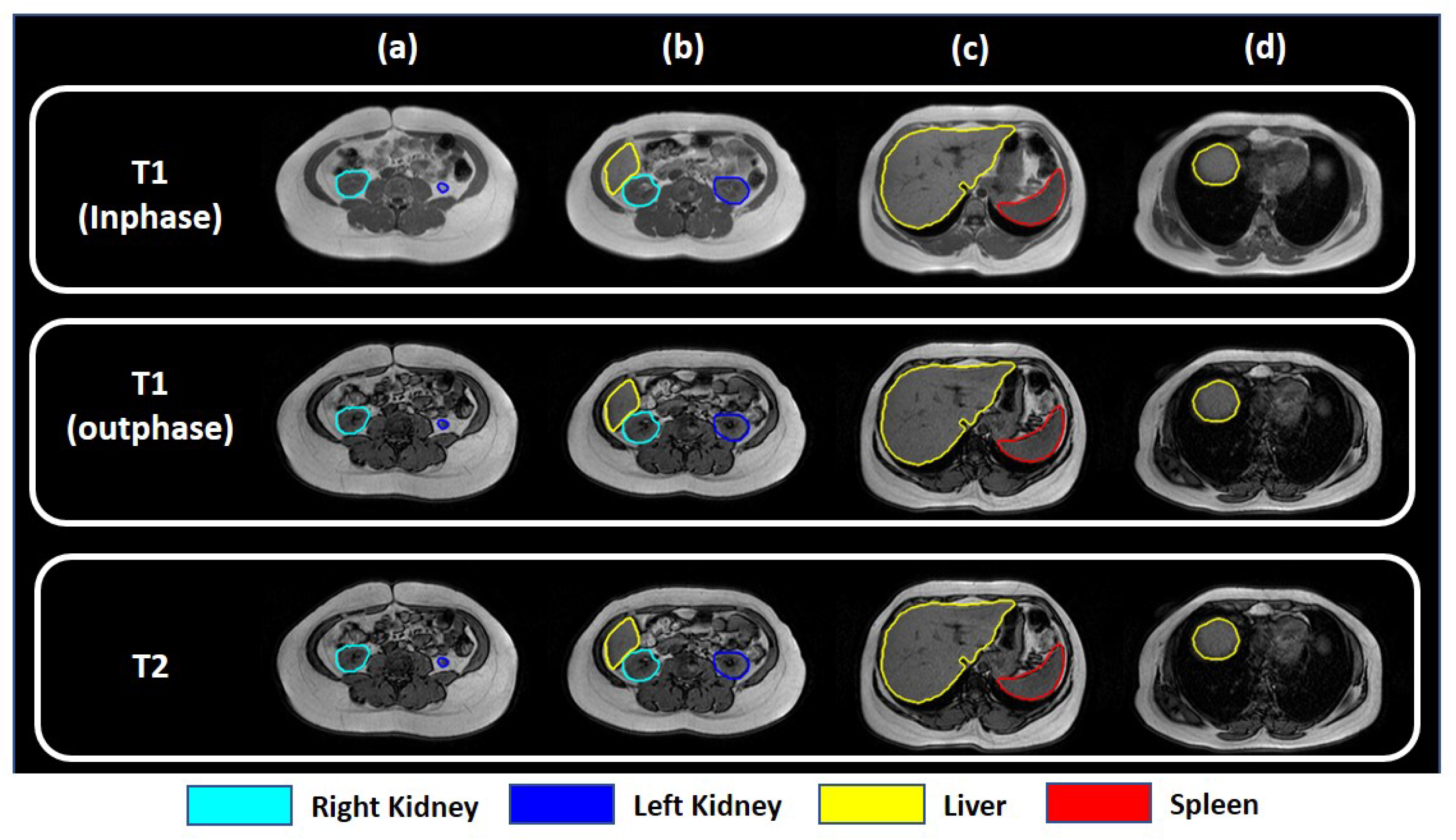 Sensors 23 08890 g003