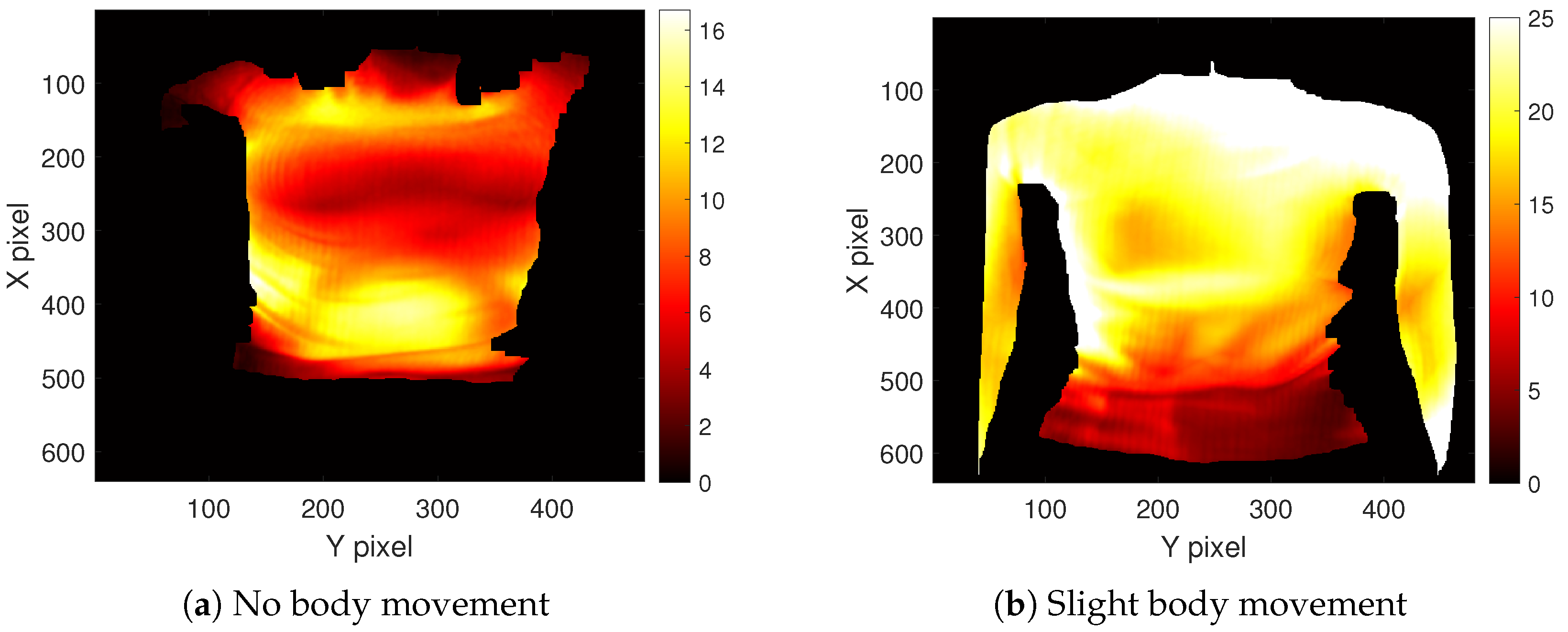 Sensors 23 09000 g004
