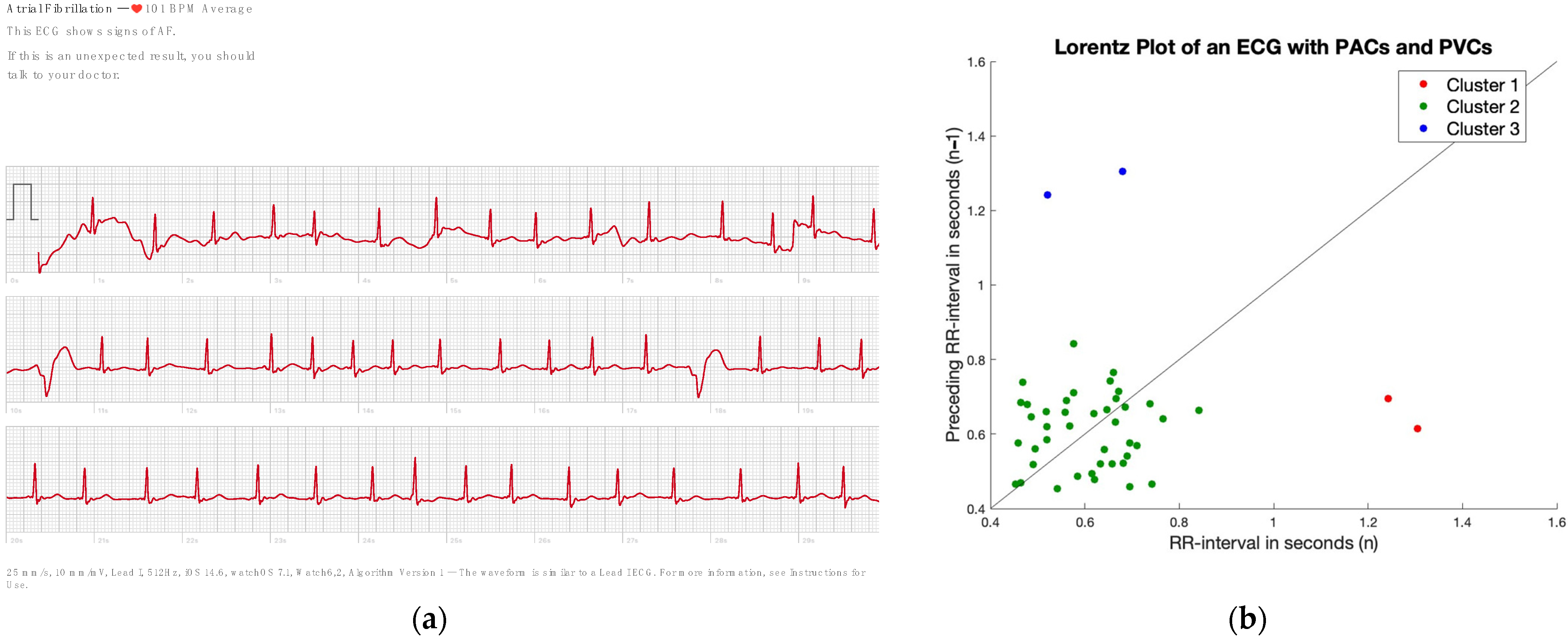 Sensors 23 09283 g004