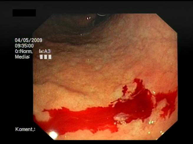 Sensors 23 09717 i005 Sensors 23 09717 i005