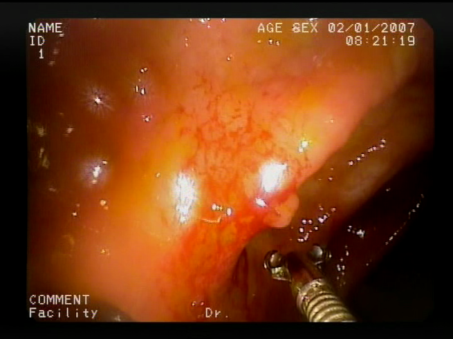 Sensors 23 09717 i011 Sensors 23 09717 i011