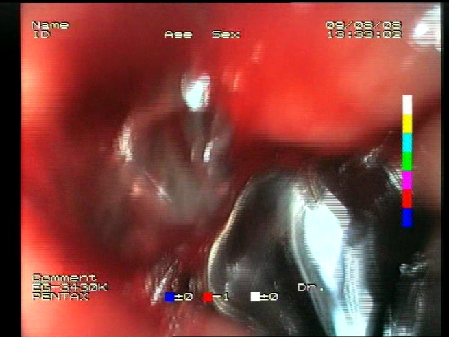 Sensors 23 09717 i017 Sensors 23 09717 i017