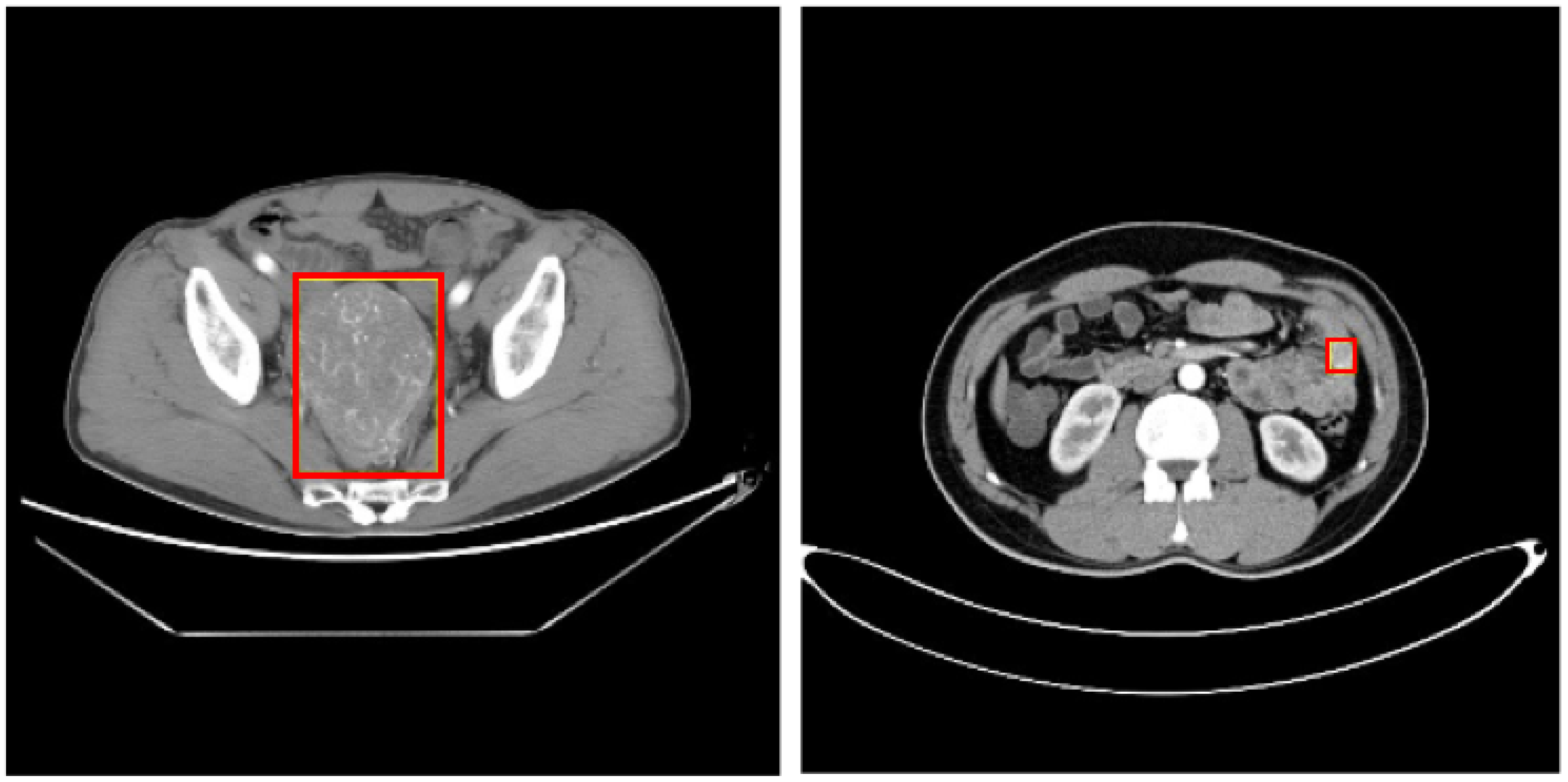 Sensors 23 09723 g001