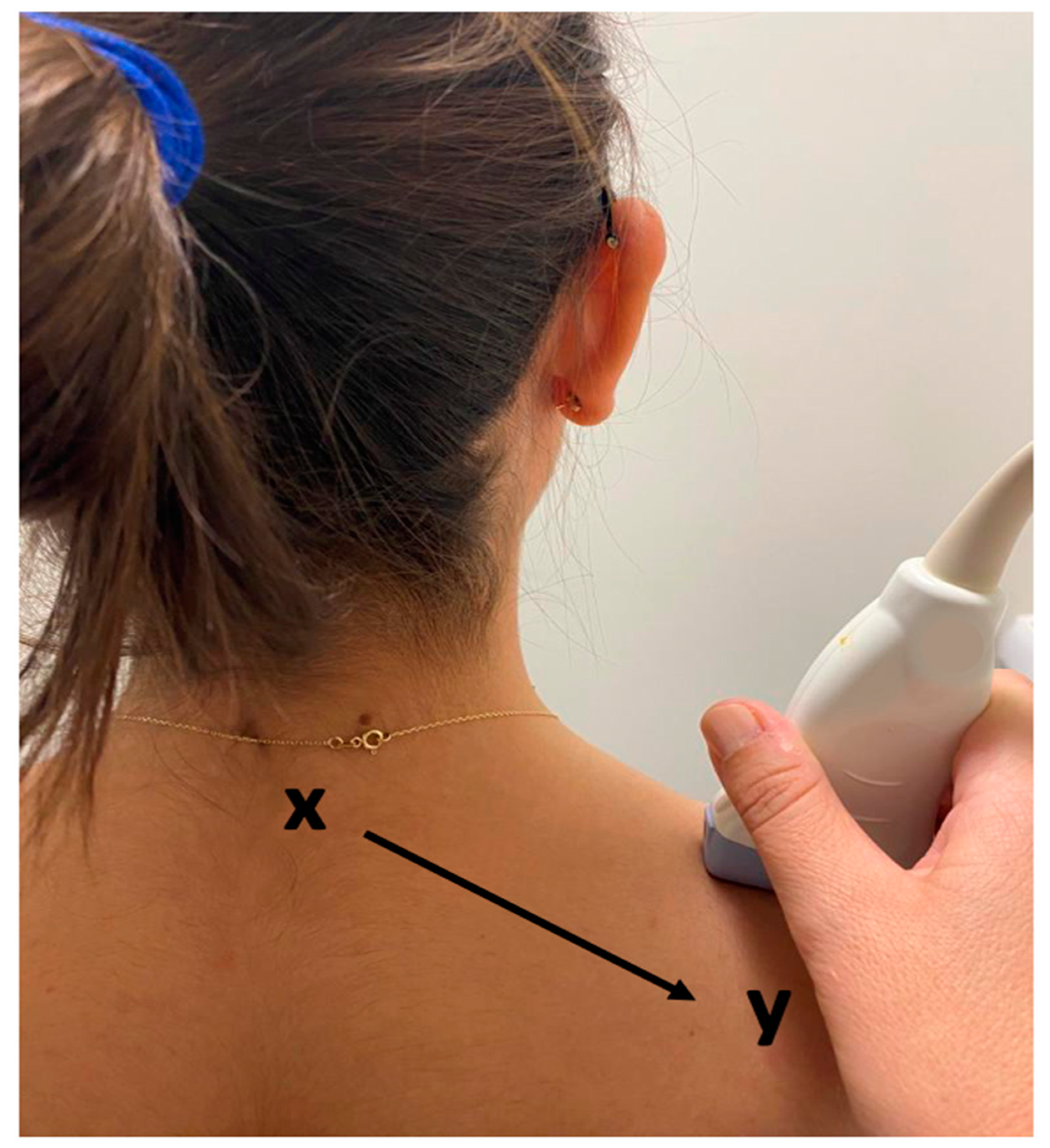 Sensors 23 09873 g001