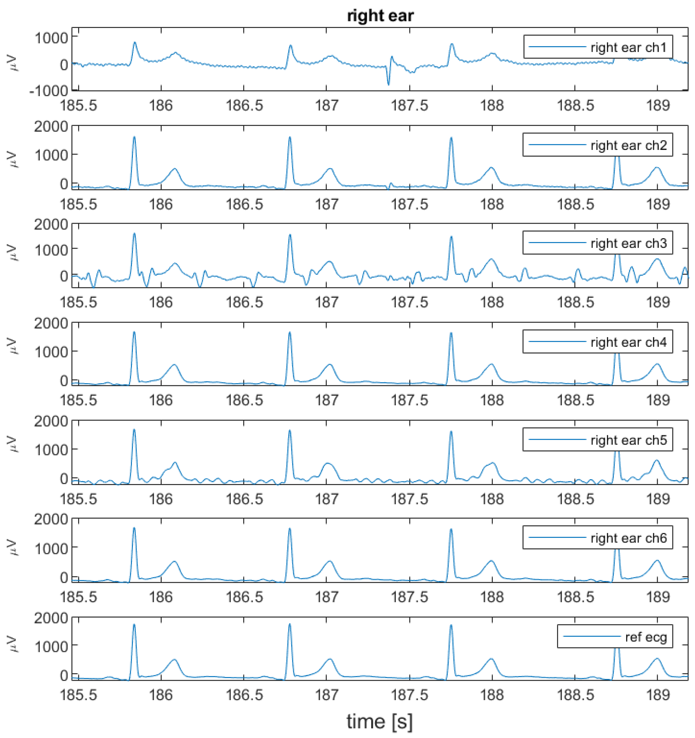 Sensors 24 00420 g005