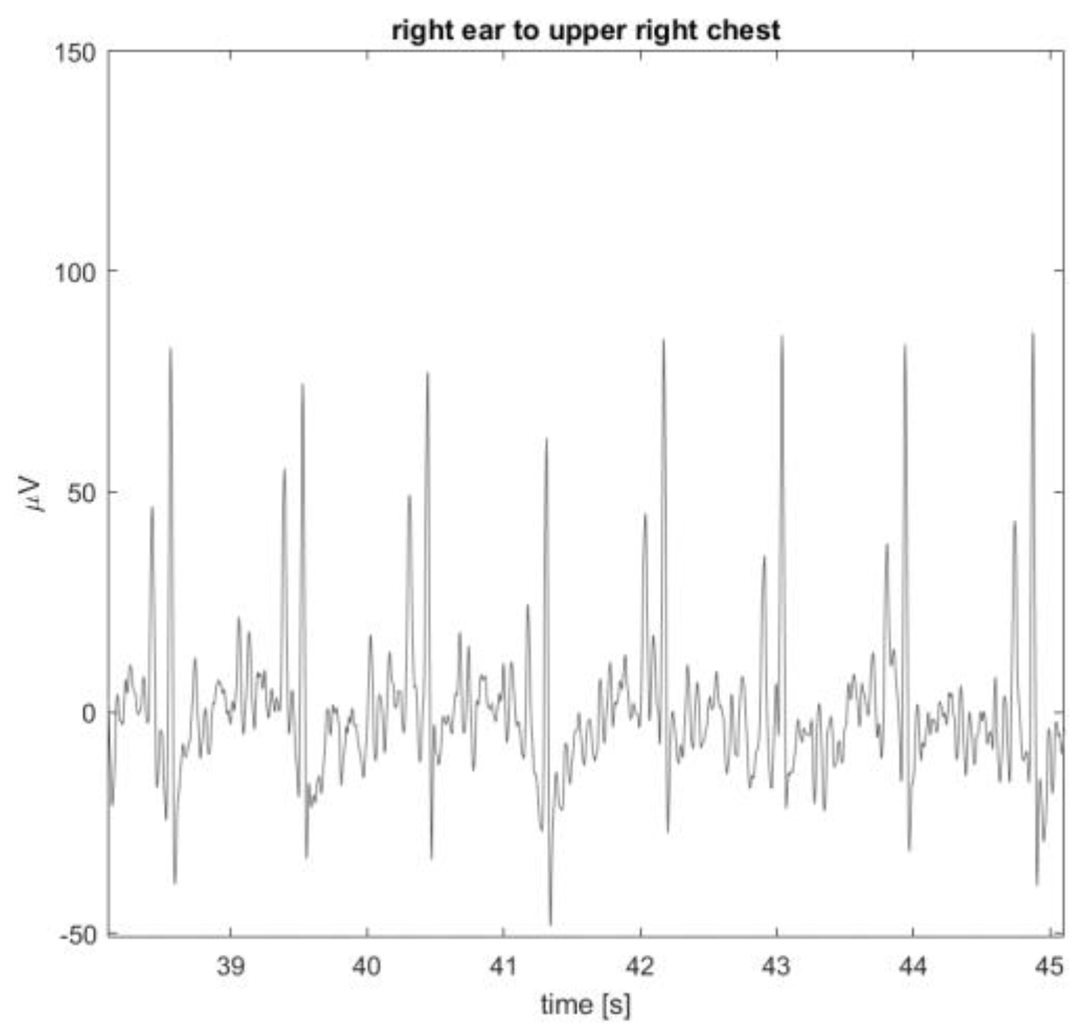 Sensors 24 00420 g011