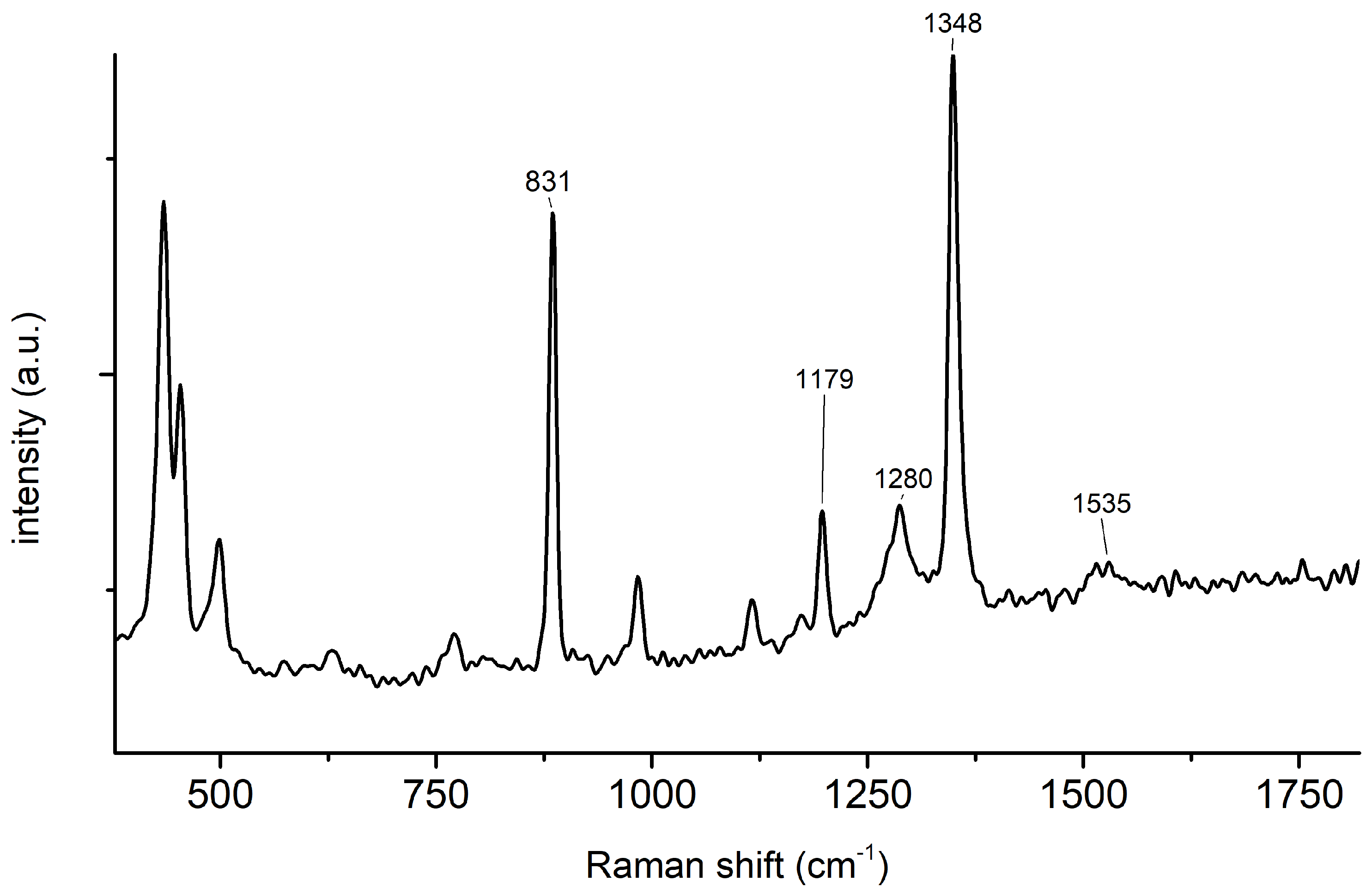 Sensors 24 00424 g0a3