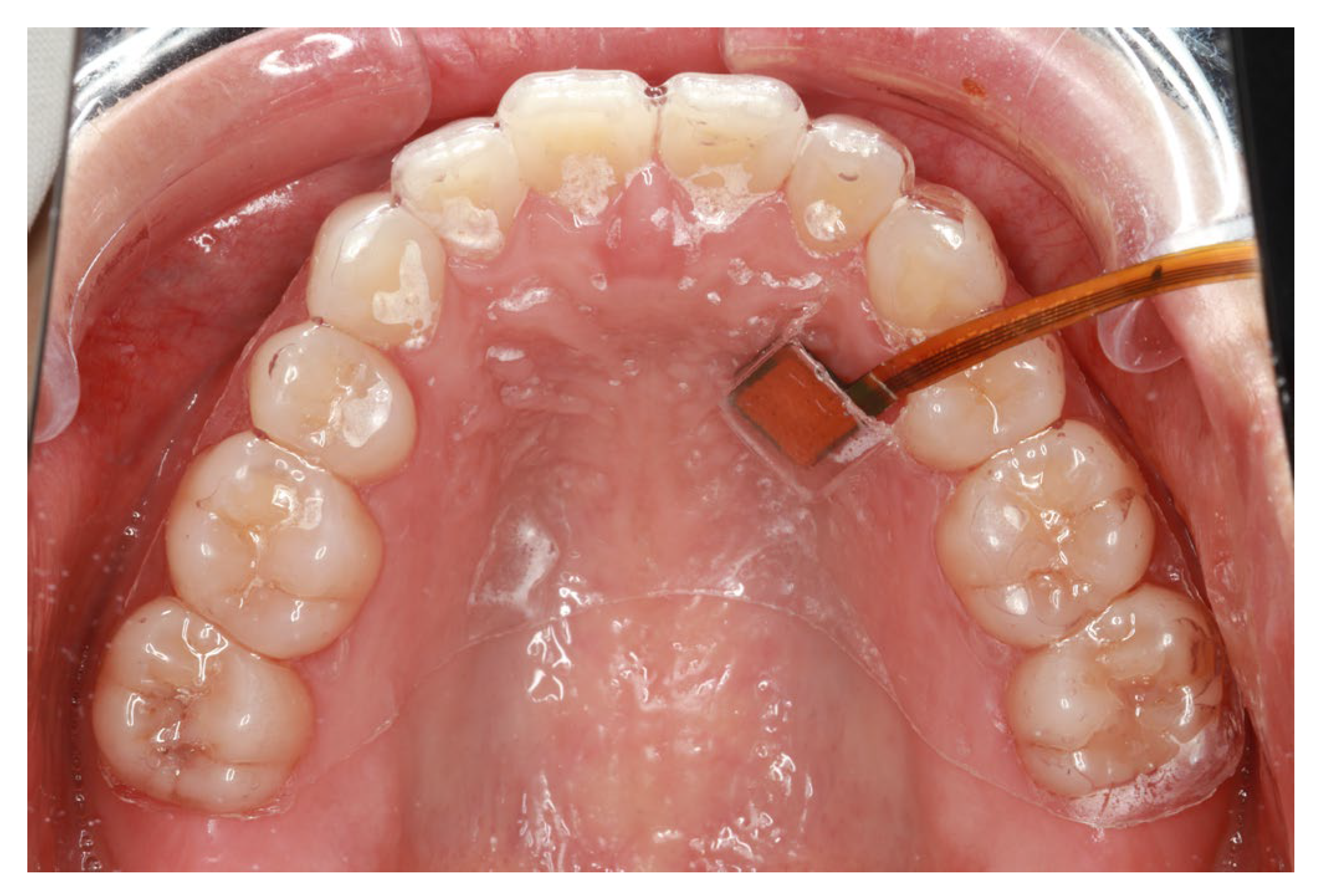 Sensors 24 00435 g007