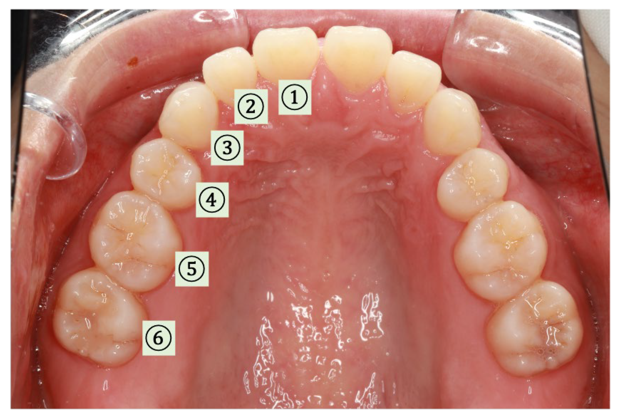 Sensors 24 00435 g008