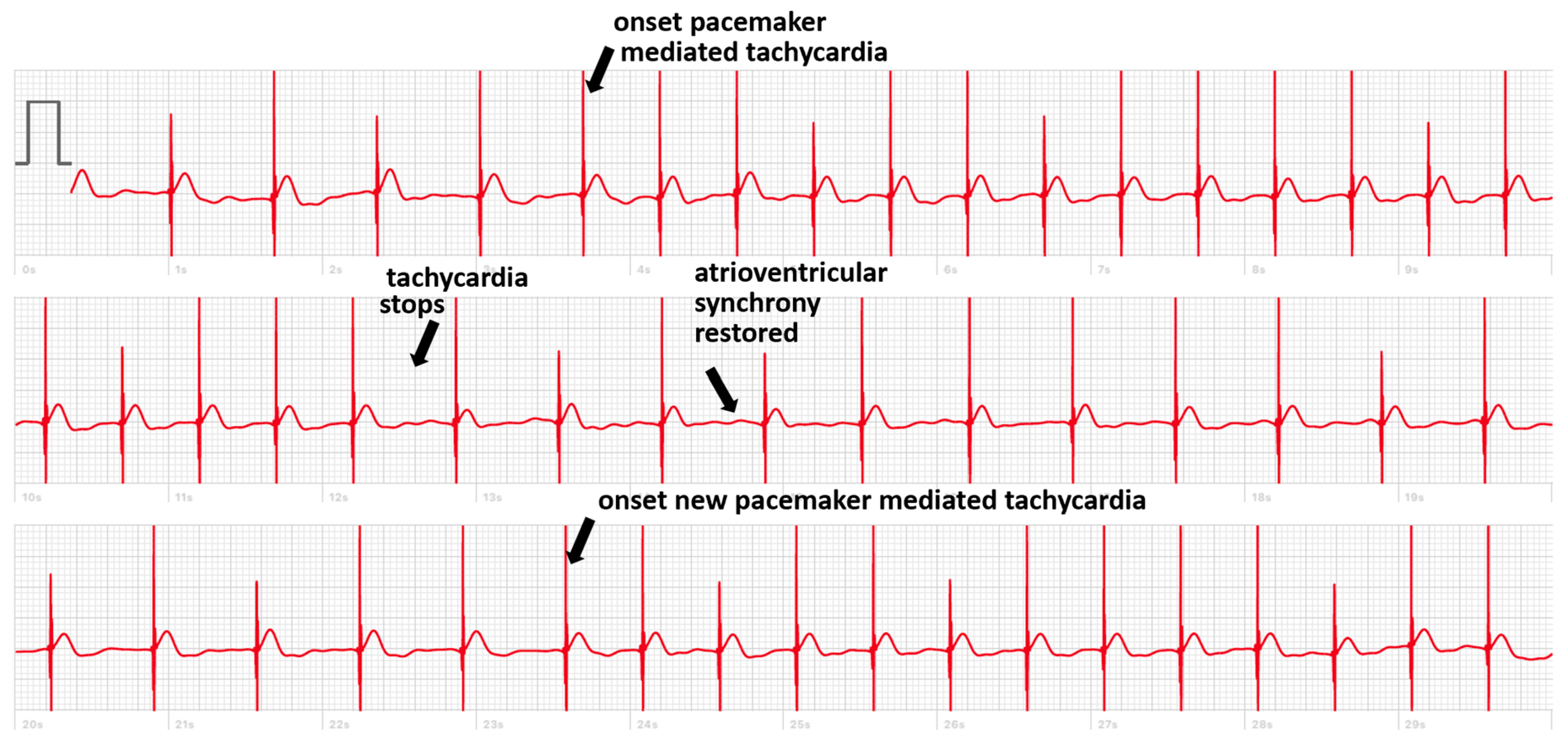 Sensors 24 00527 g003