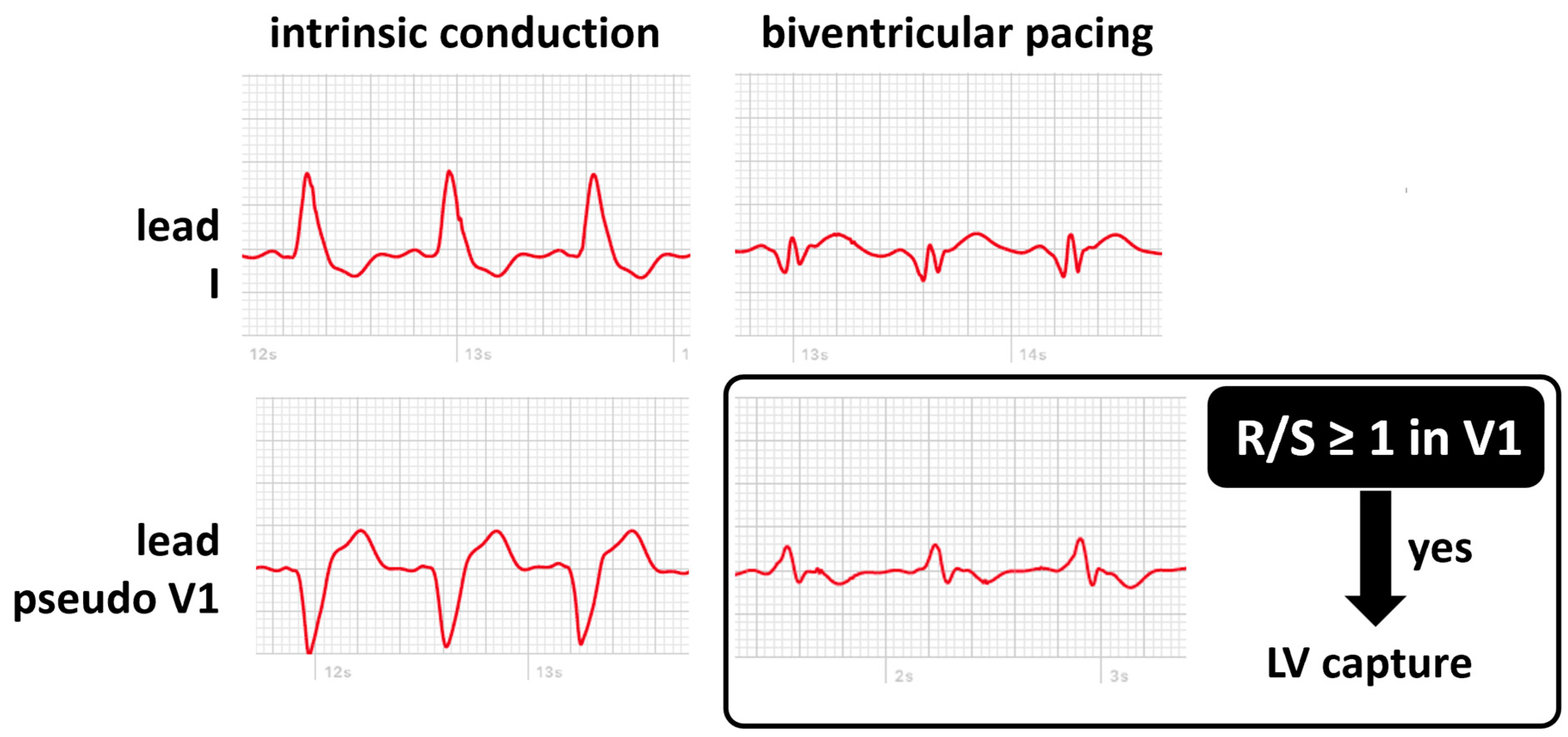 Sensors 24 00527 g005