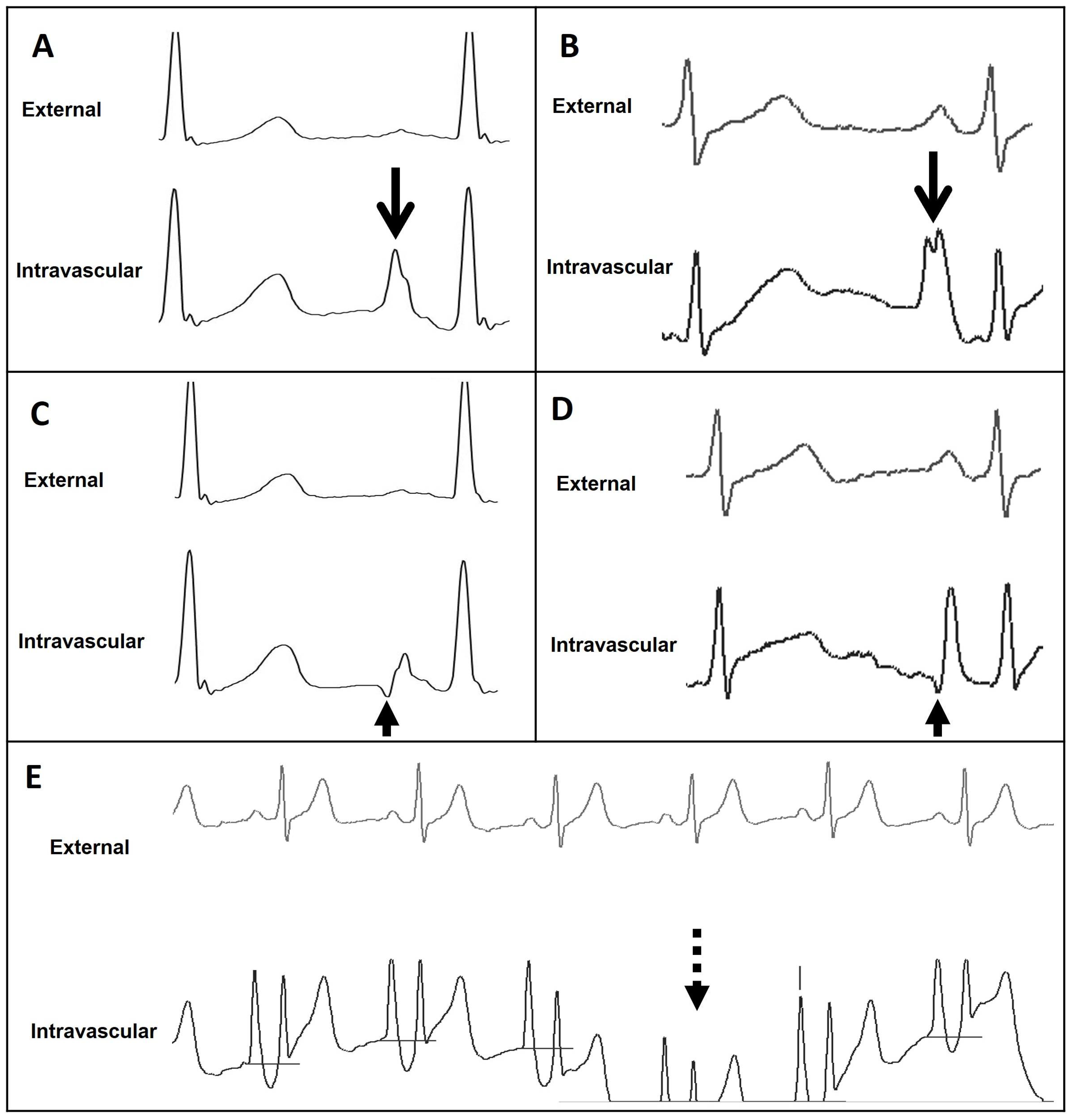 Sensors 24 00894 g007