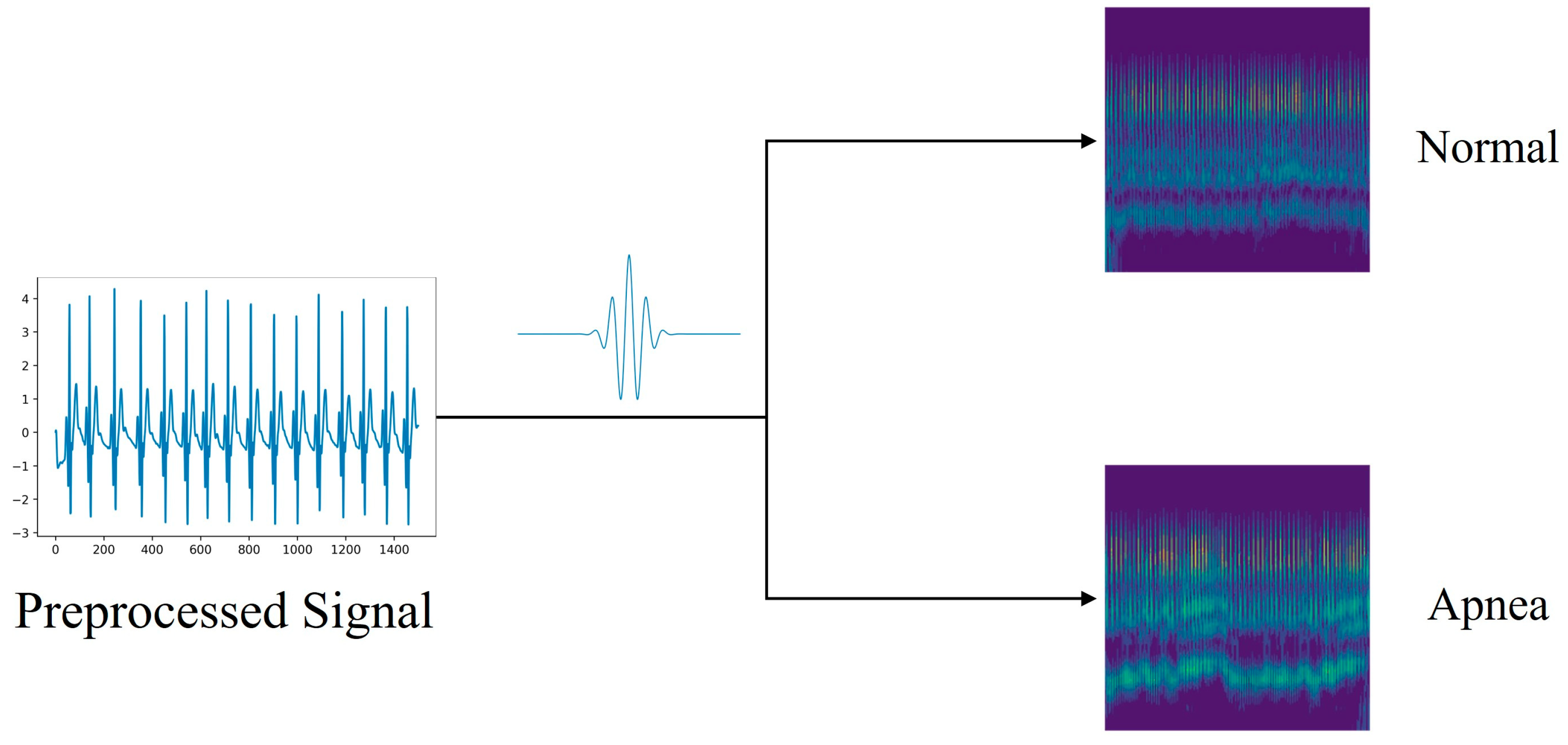 Sensors 24 01159 g003